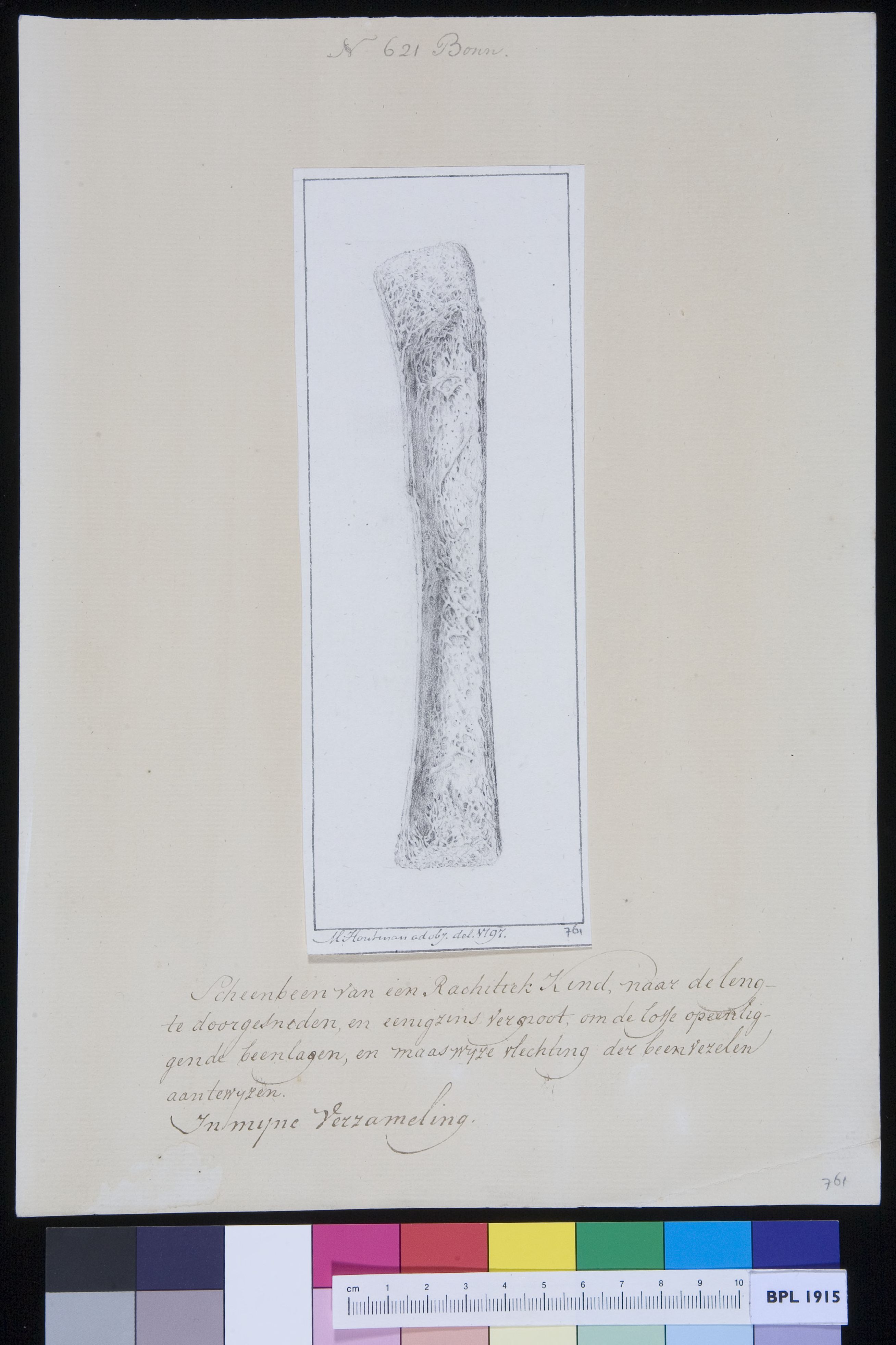 Tibia