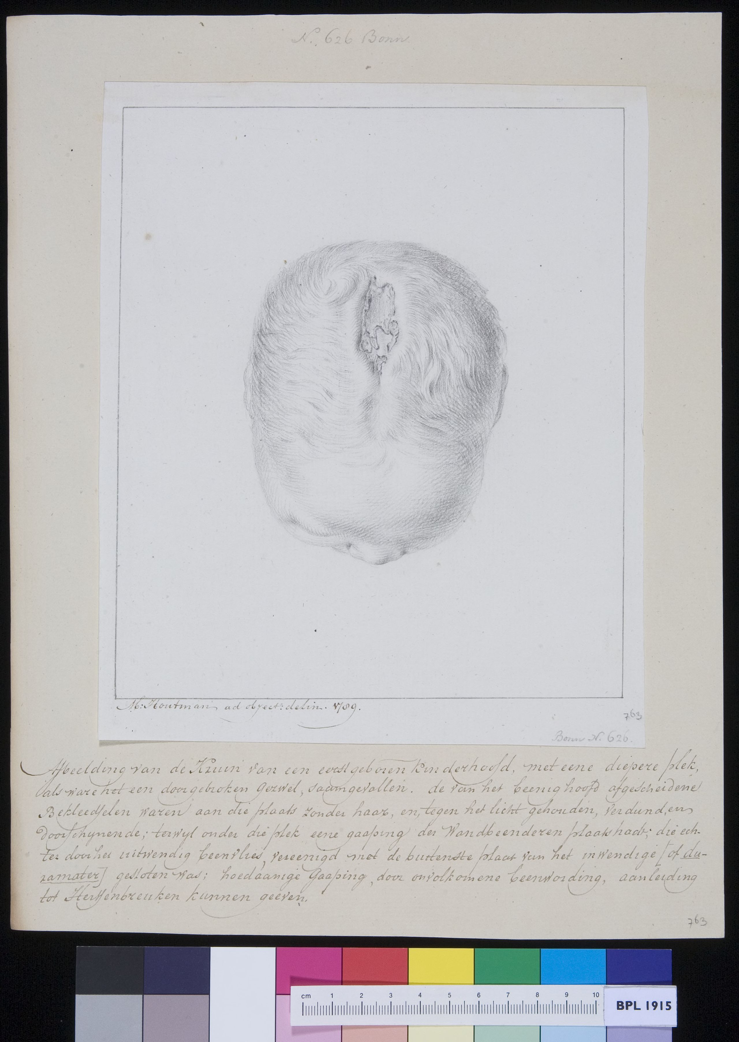 Head of a child, seen from above