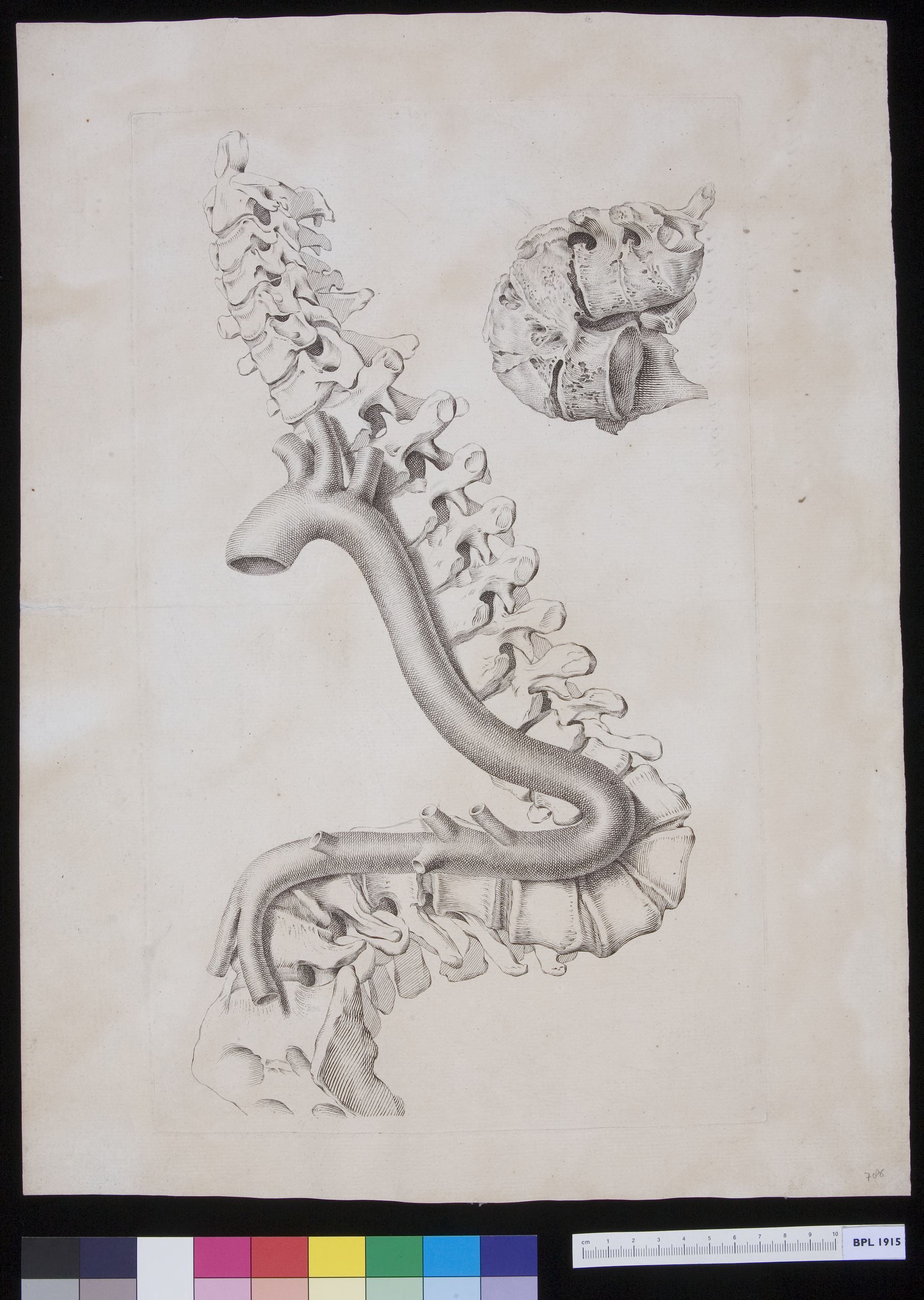 Specimens: dorsal vertebra
