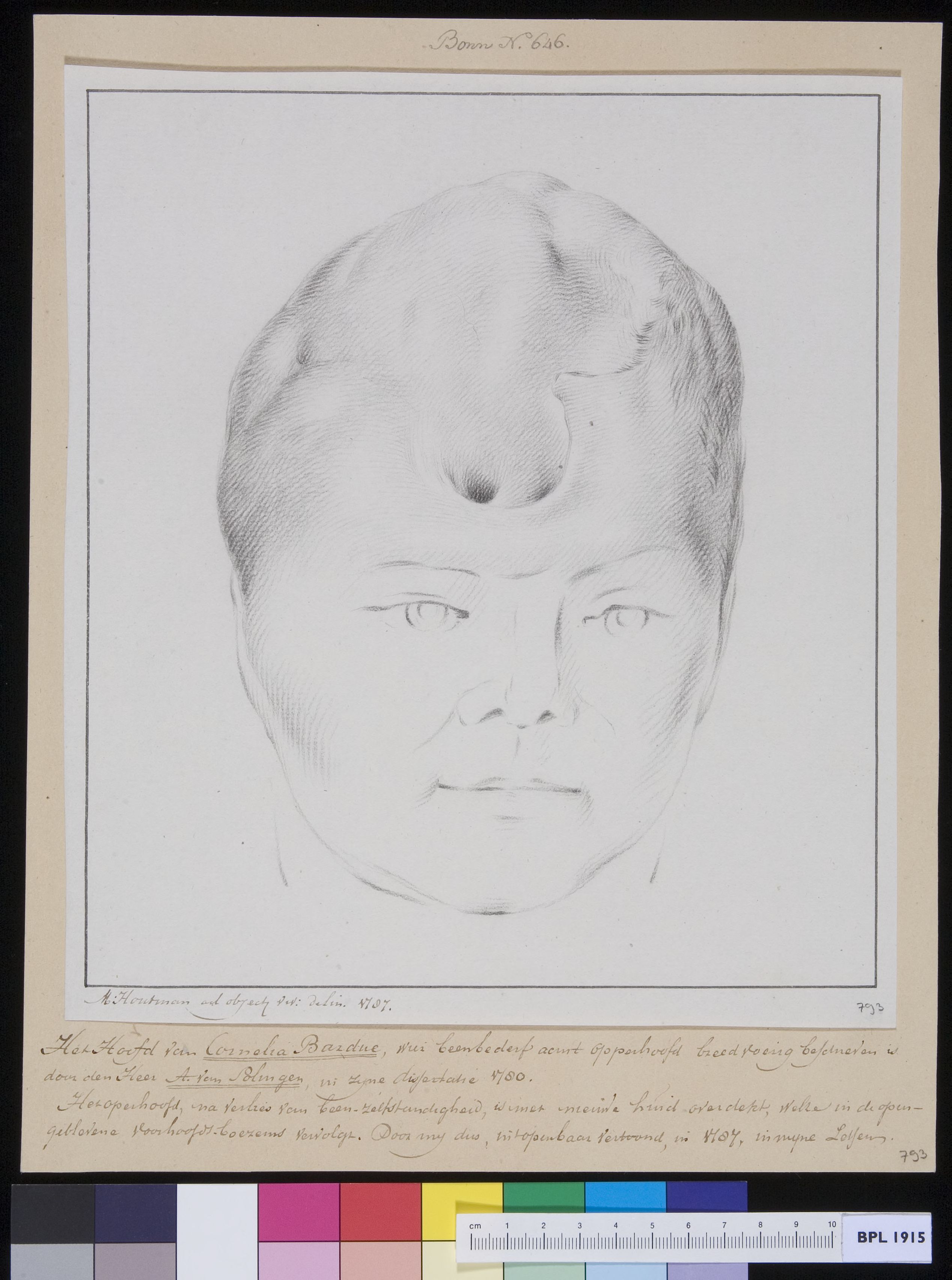 Ms Cornelis Bardue, a patient suffering from loss of bone structure