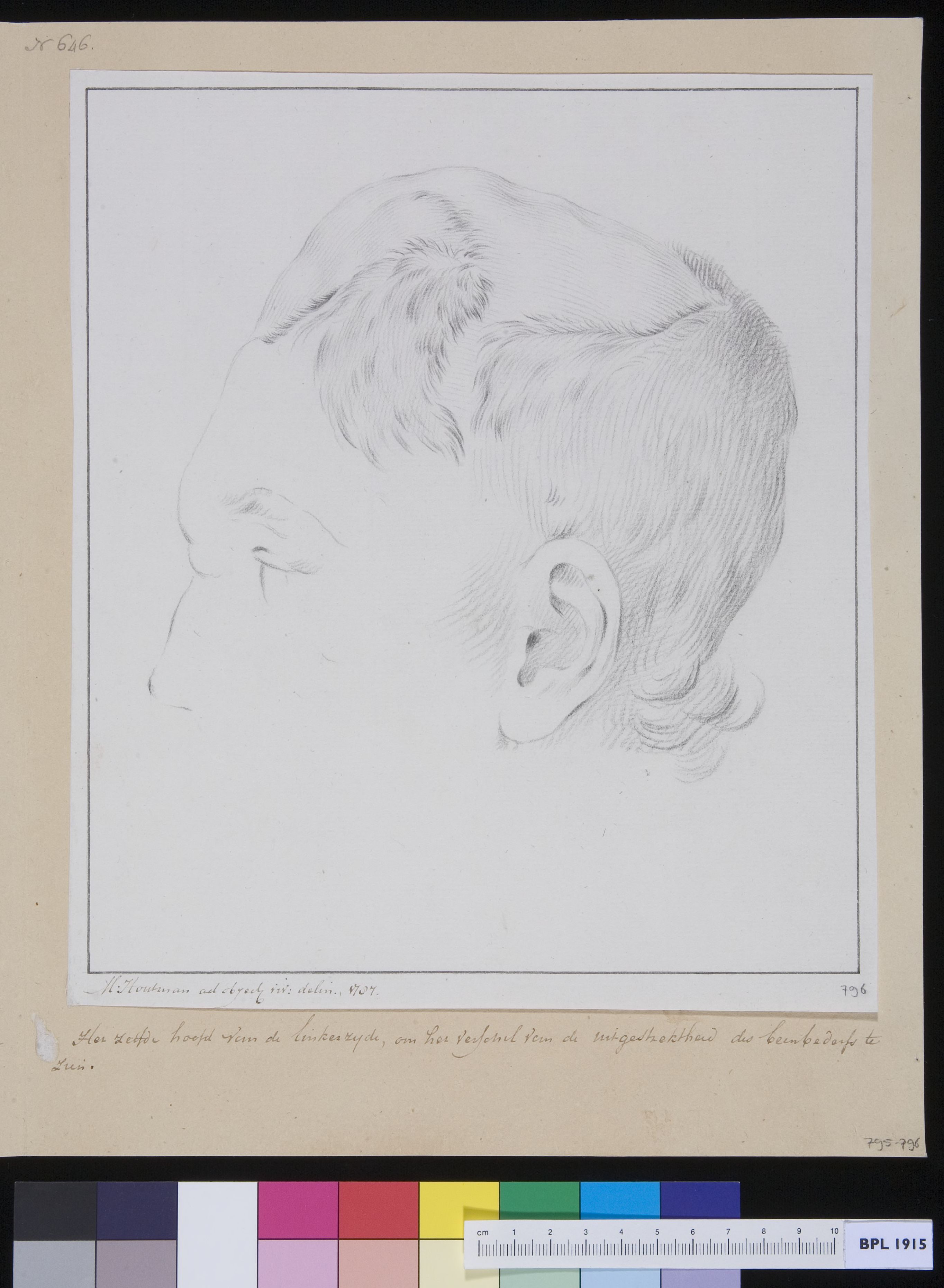 Ms Cornelis Bardue, a patient suffering from loss of bone structure
