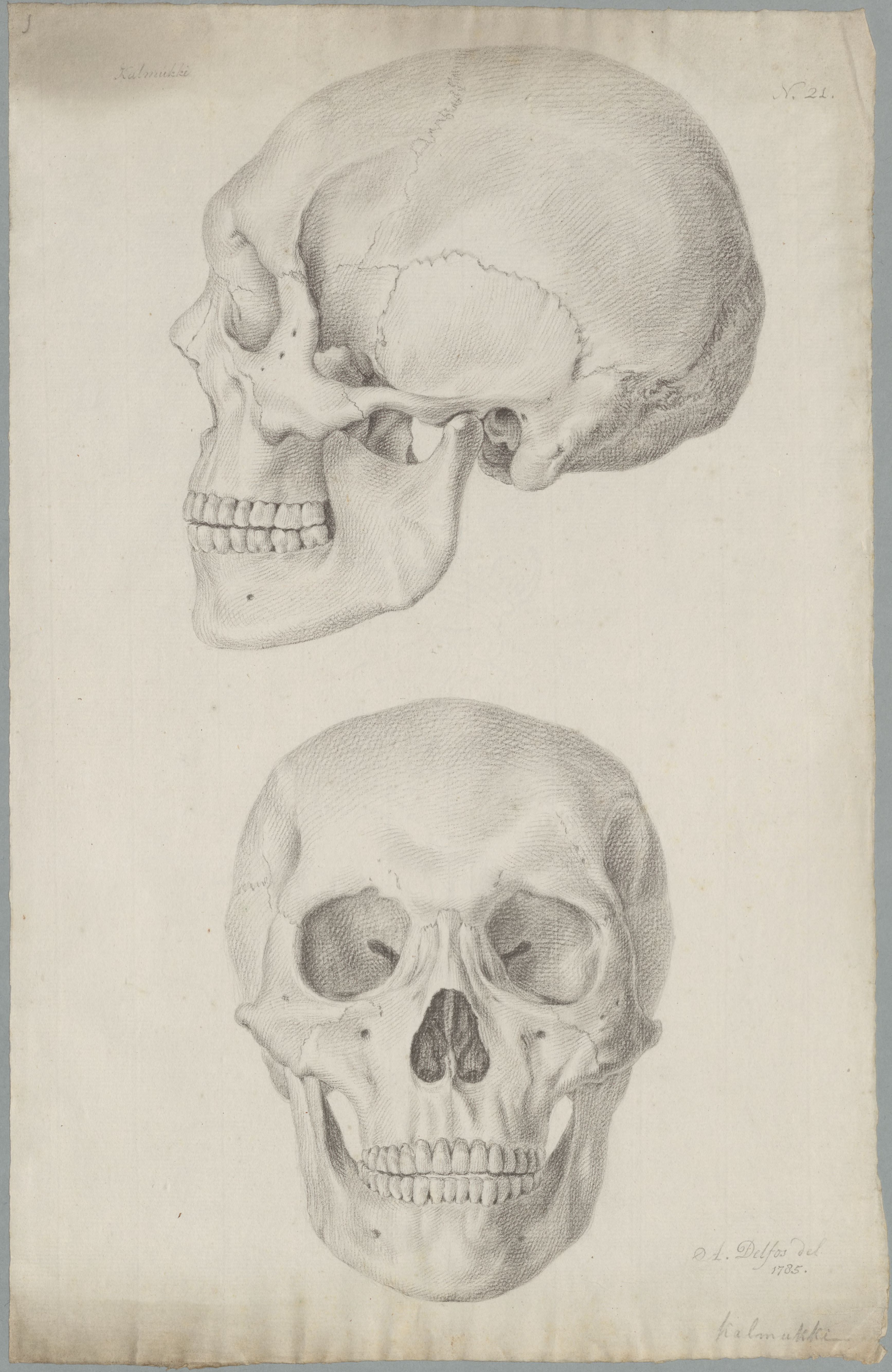 Specimens: skulls (Kalmyks)