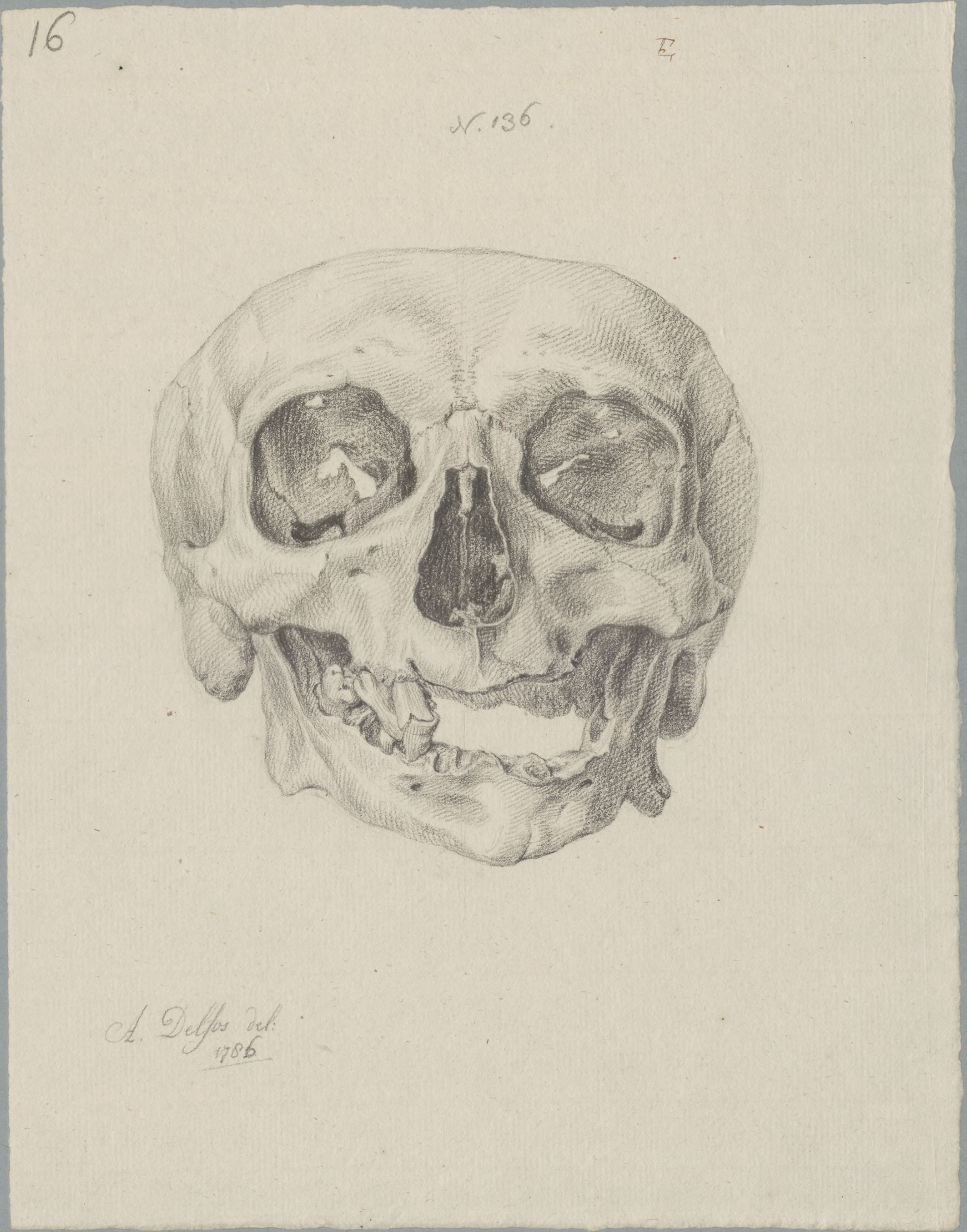 Specimens: deformed jaw