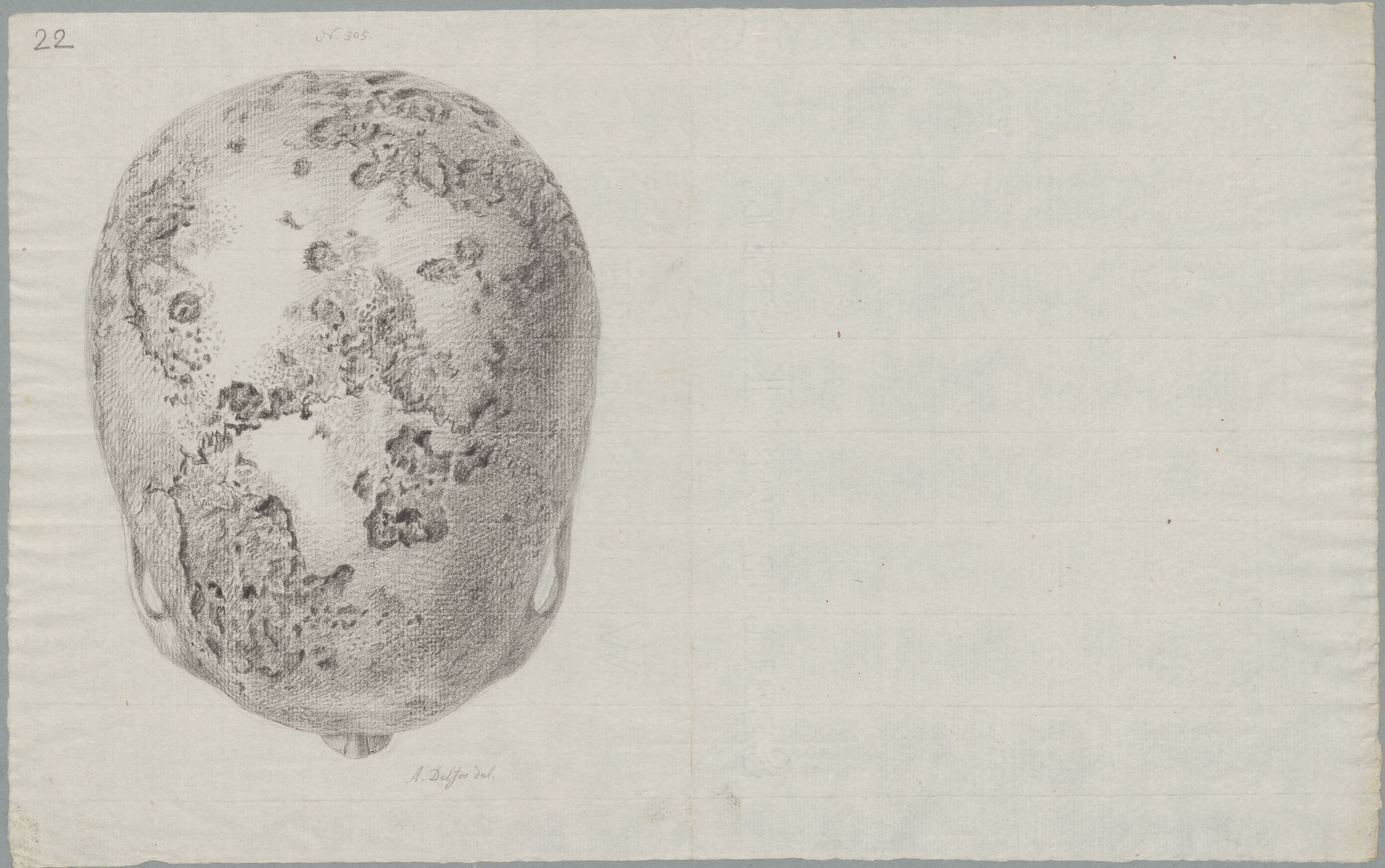 Specimens: skull, syphilis