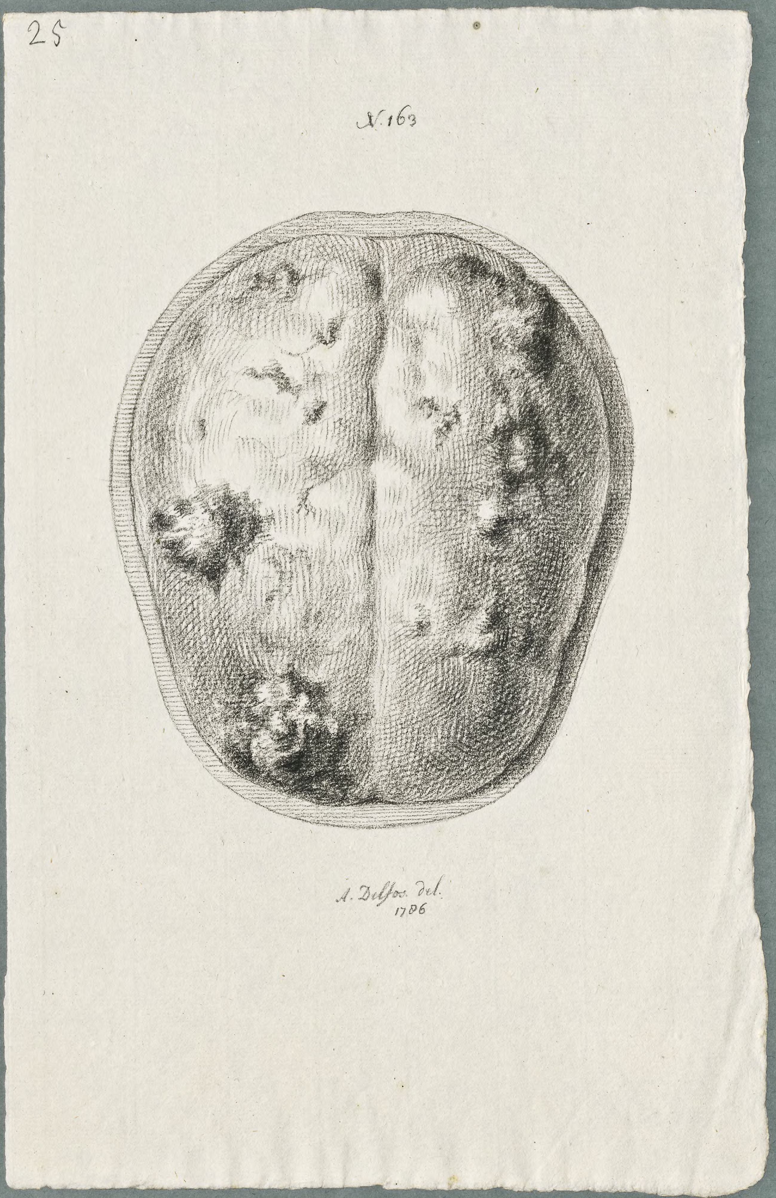Specimens: skull, syphilis