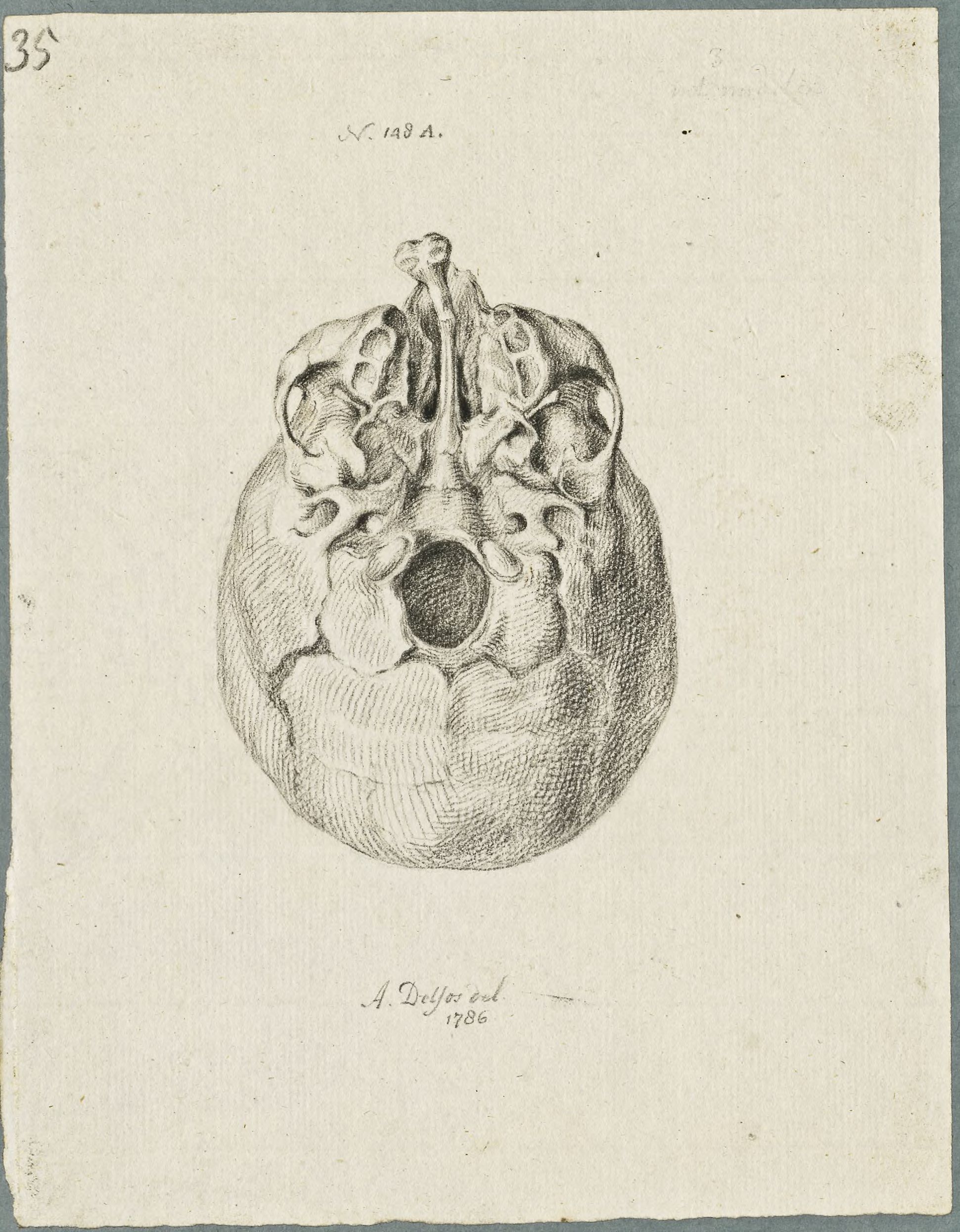 Specimens: skull of a child with cleft lip