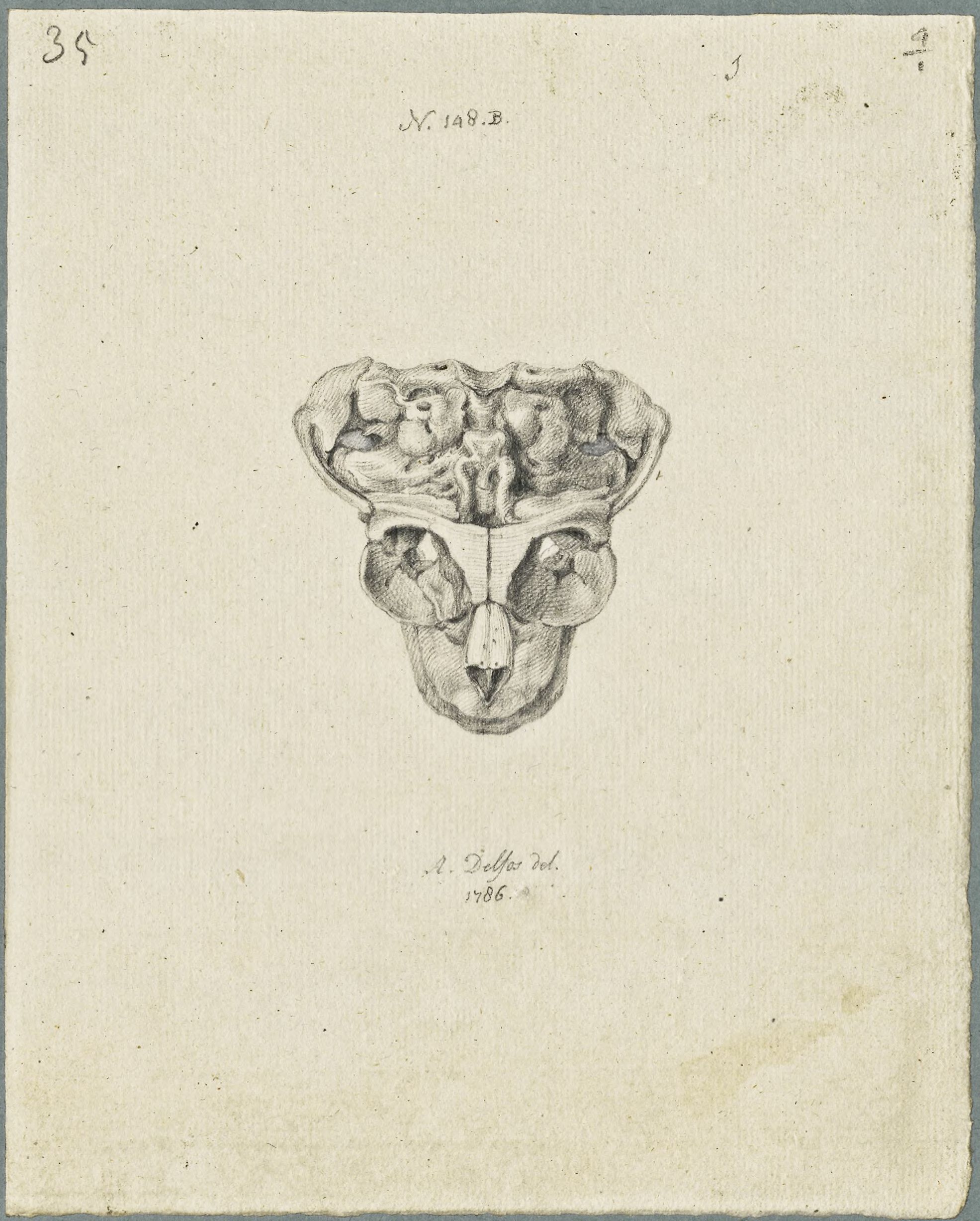 Specimens: skull of a child with cleft lip