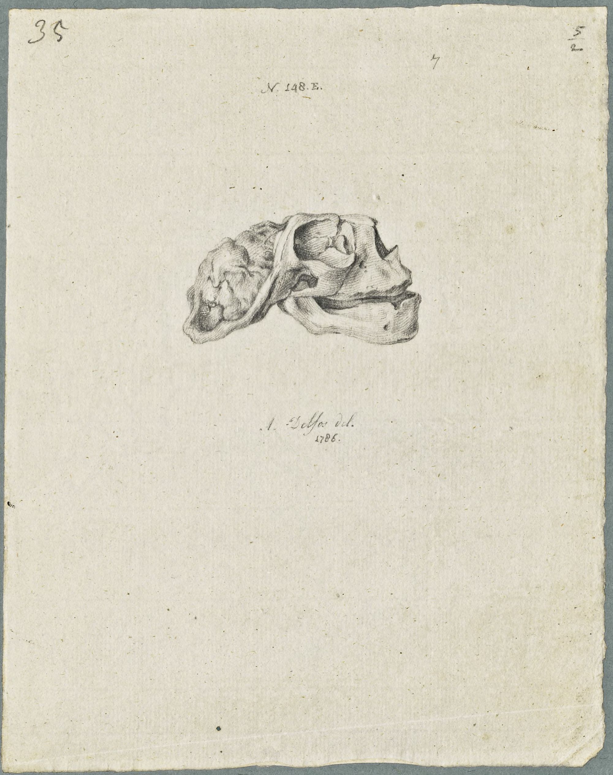 Specimens: skull of a child with cleft lip
