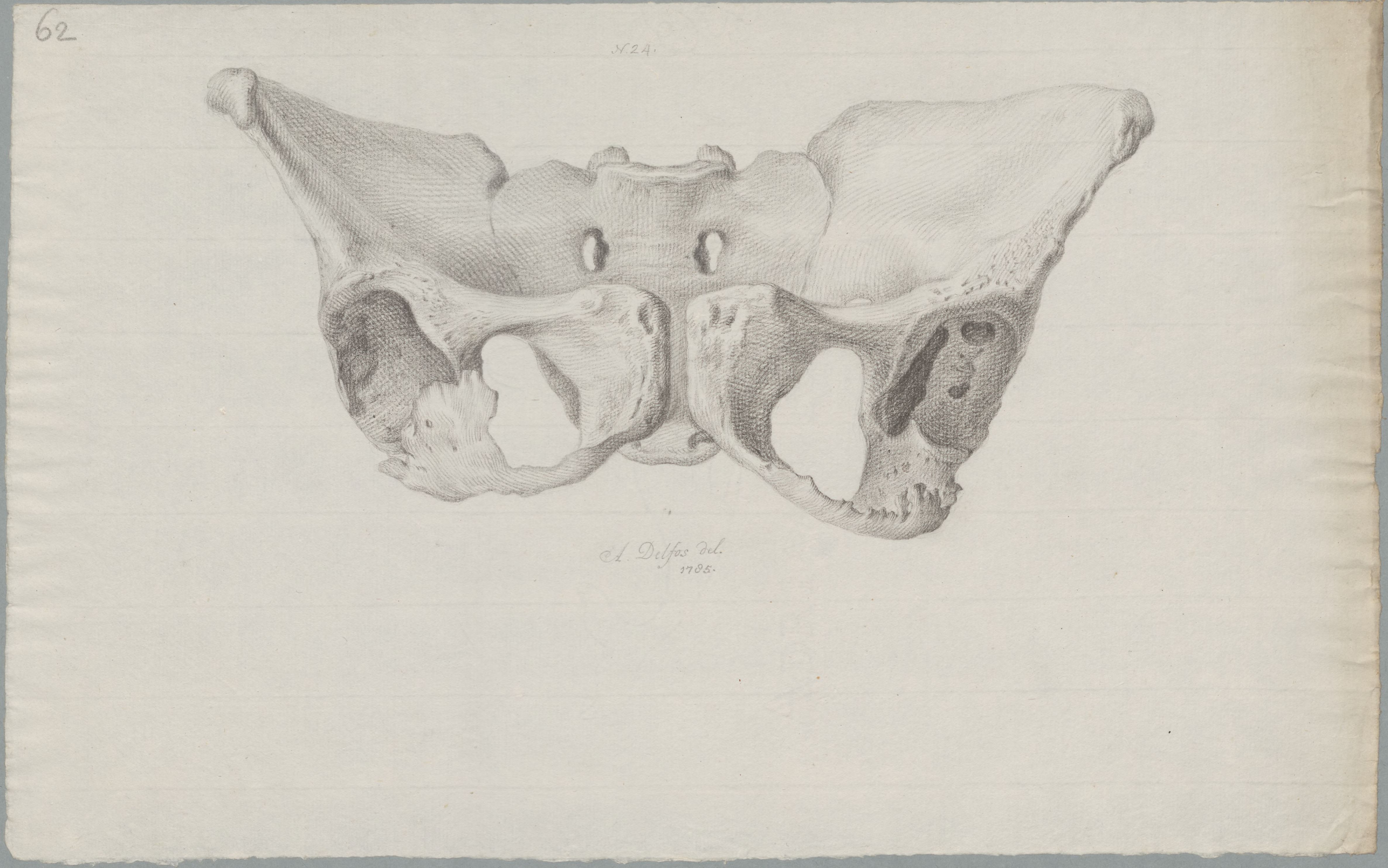 Specimens: pelvis