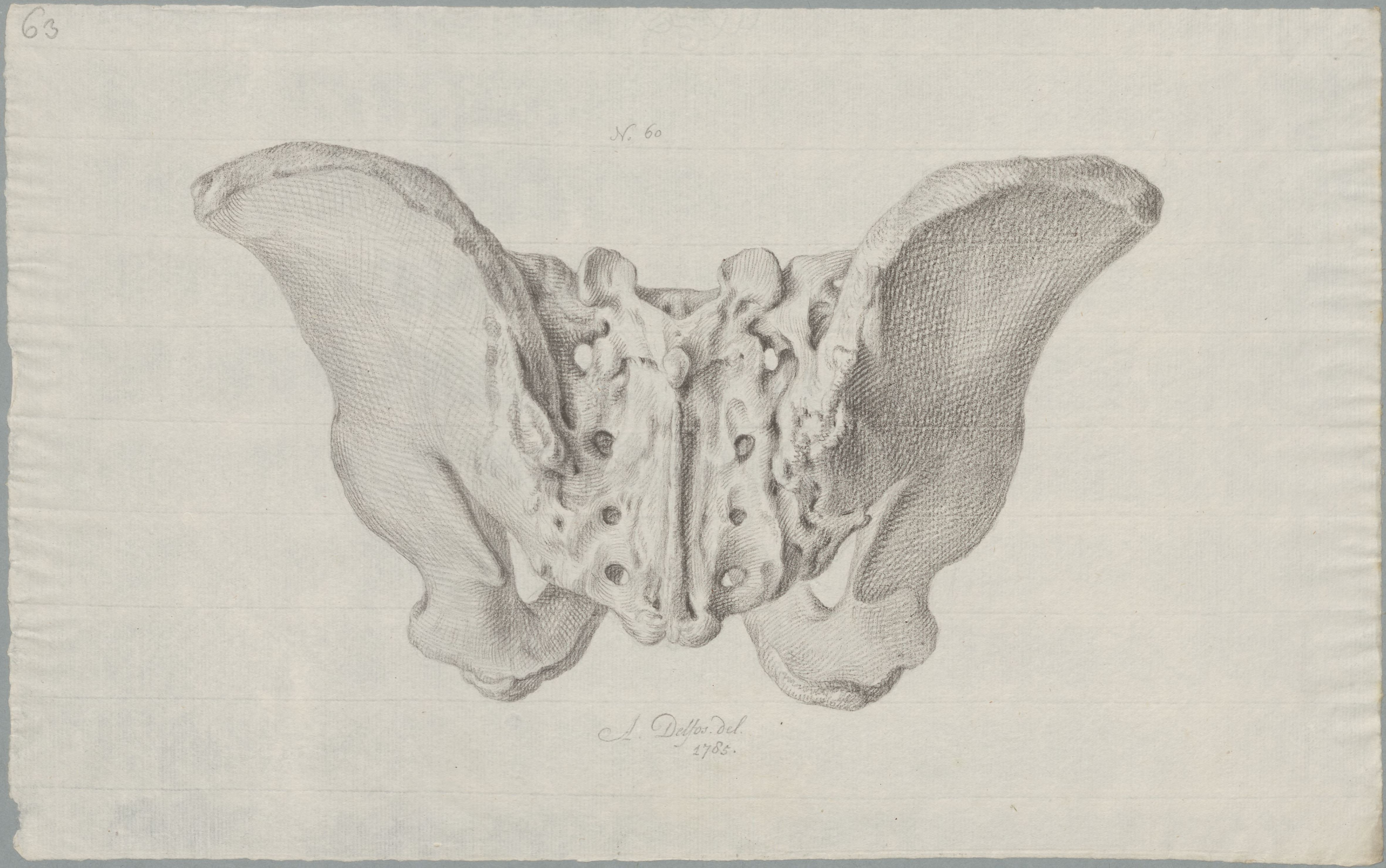 Specimens: pelvis