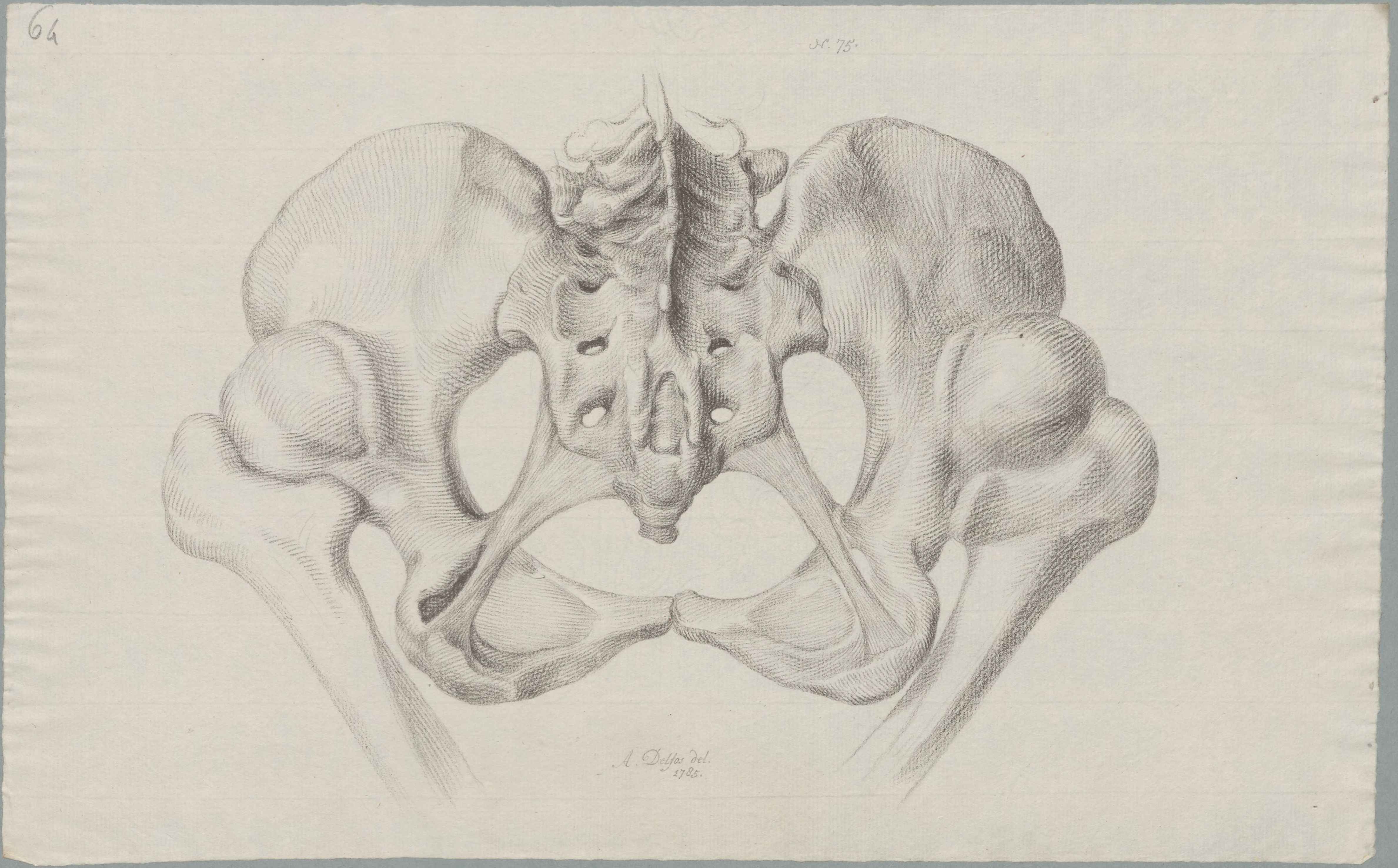 Specimens: pelvis
