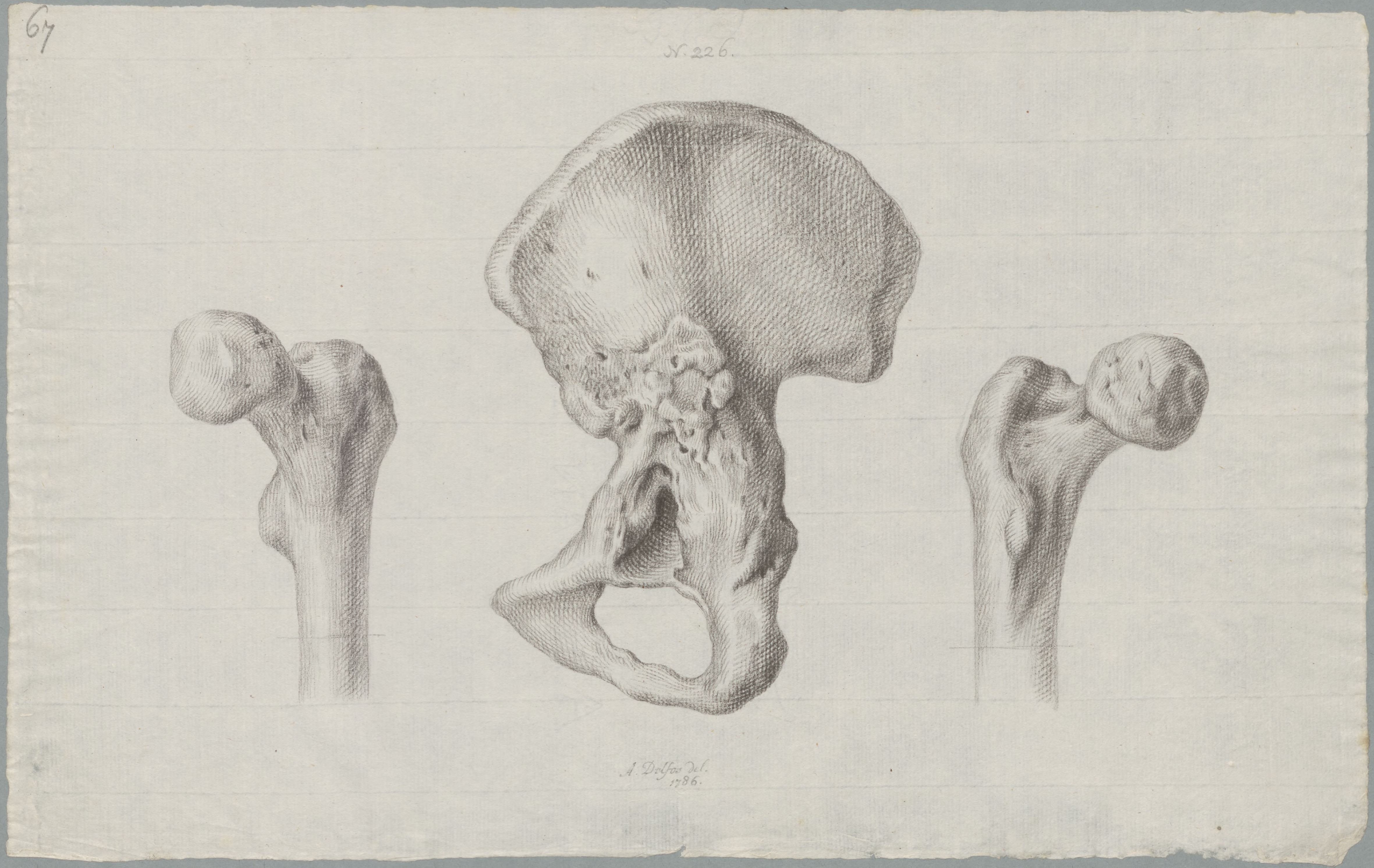 Specimens: pelvis