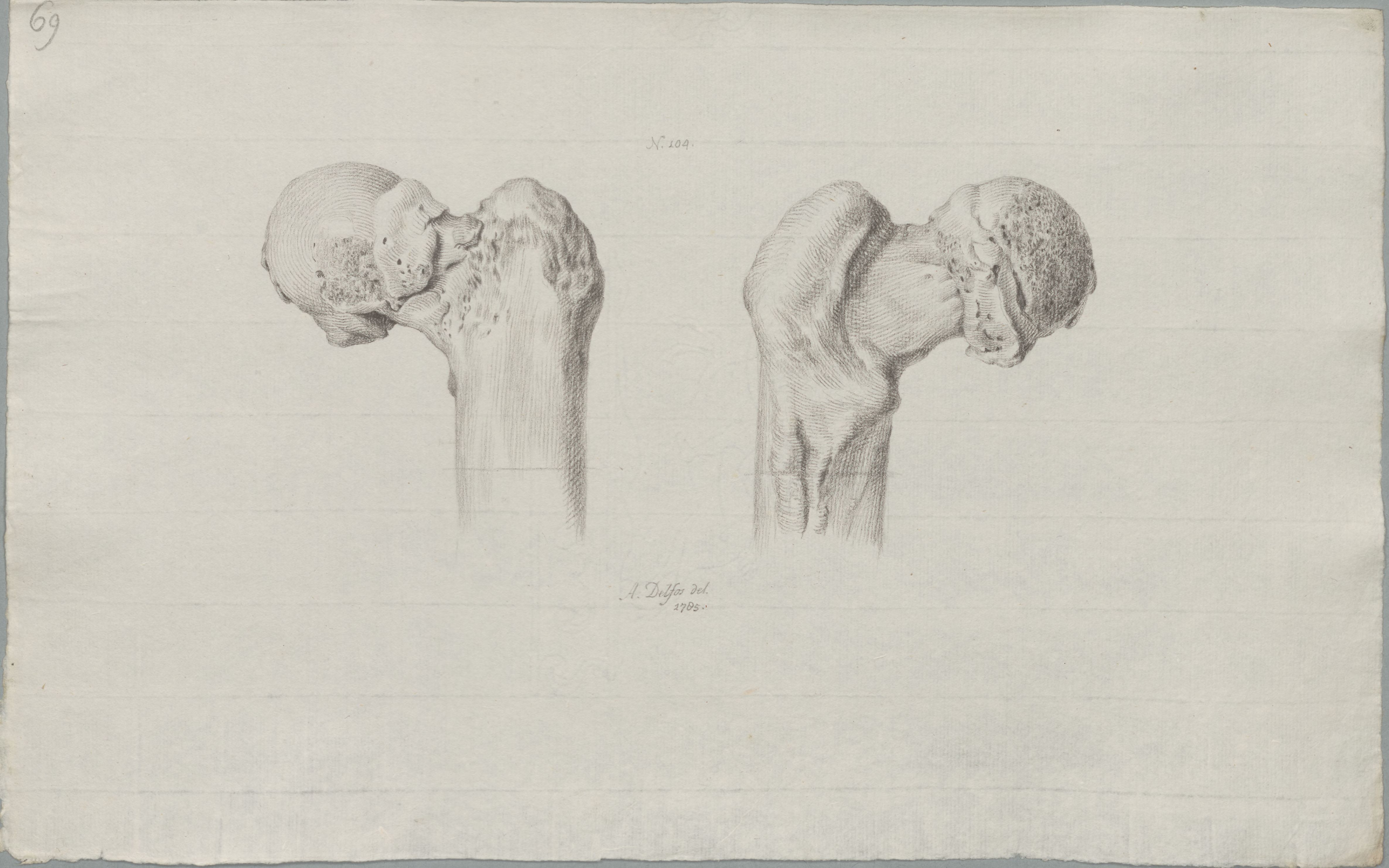 Specimens: acetbulum