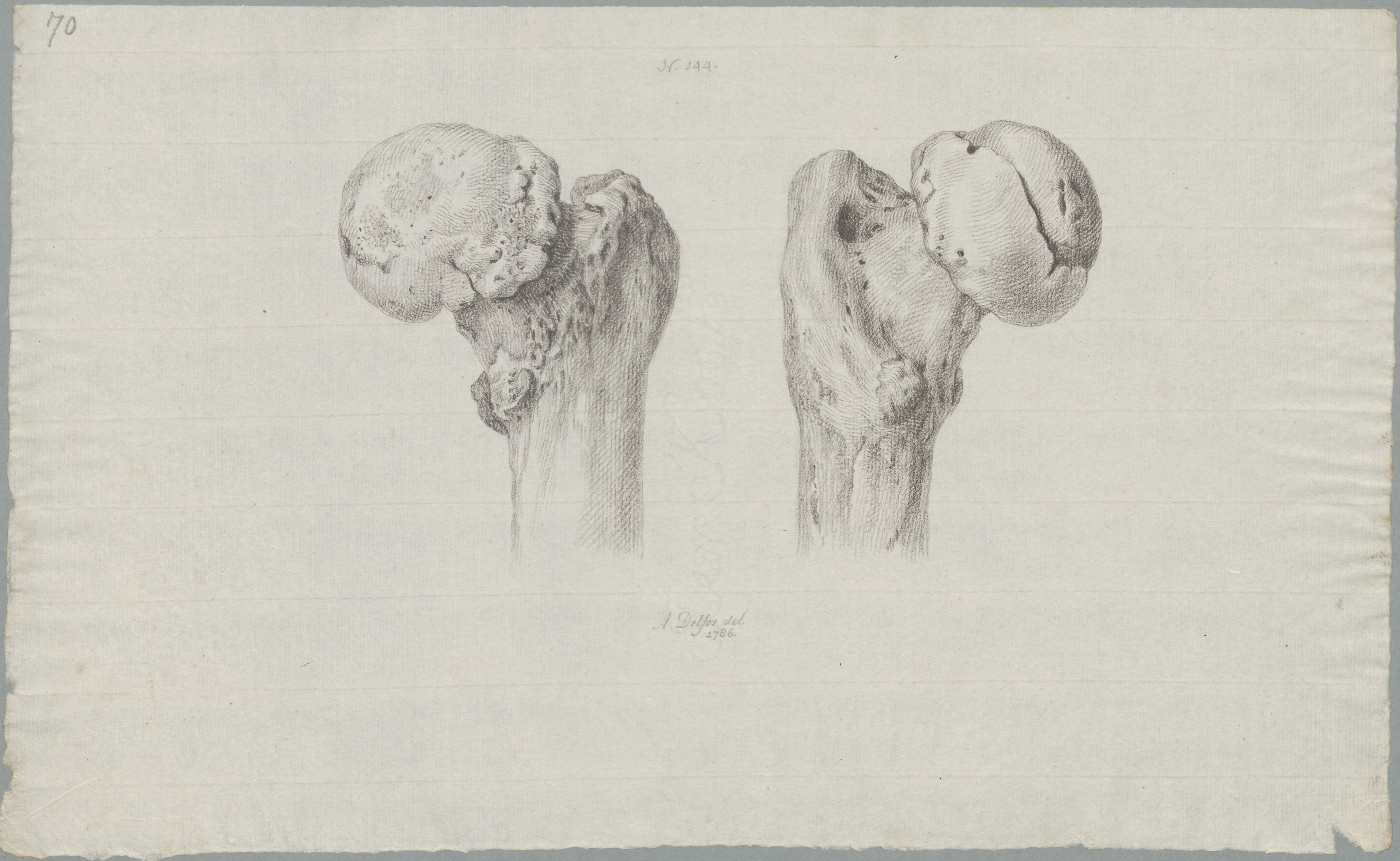 Specimens: femur