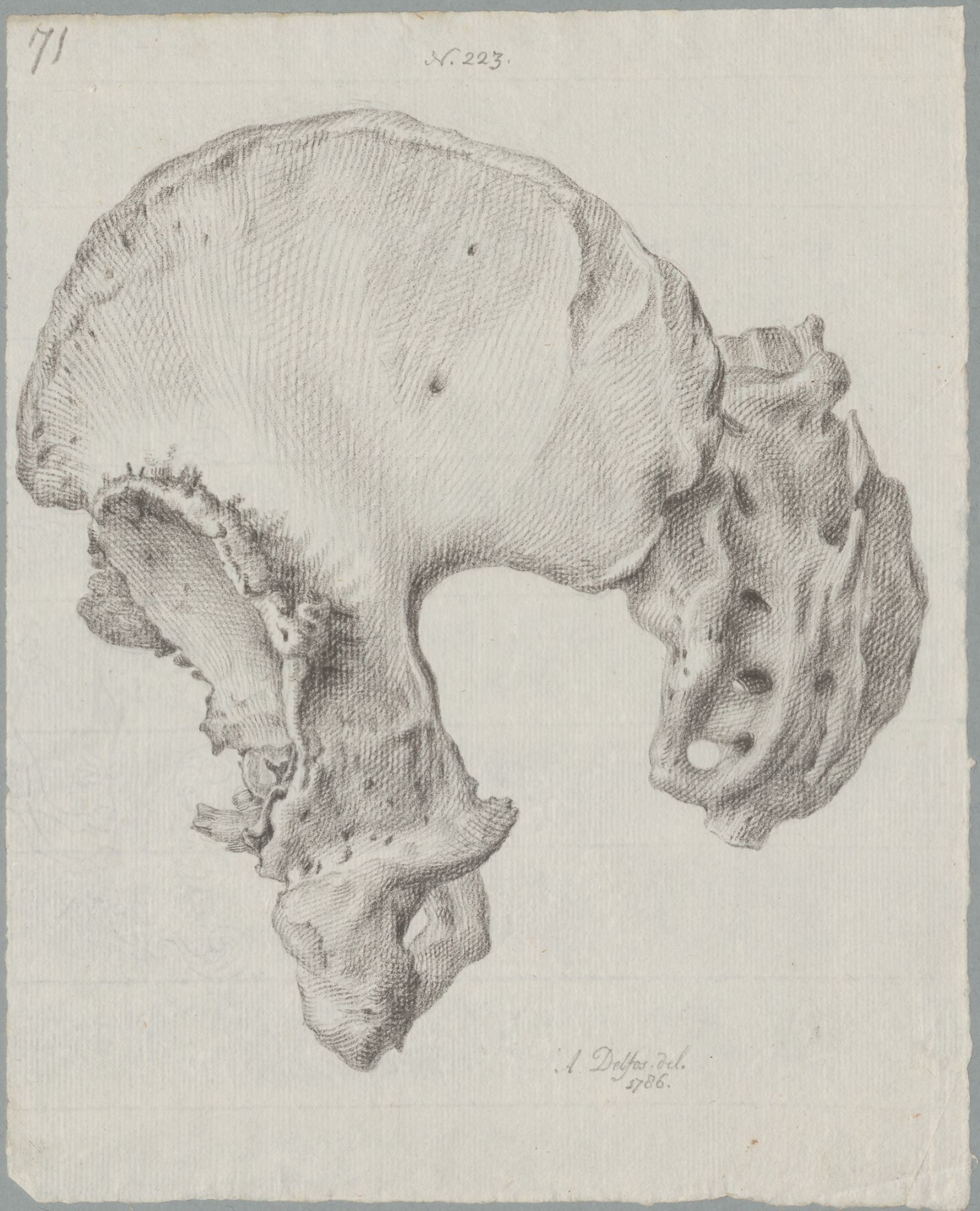 Specimens: pelvis