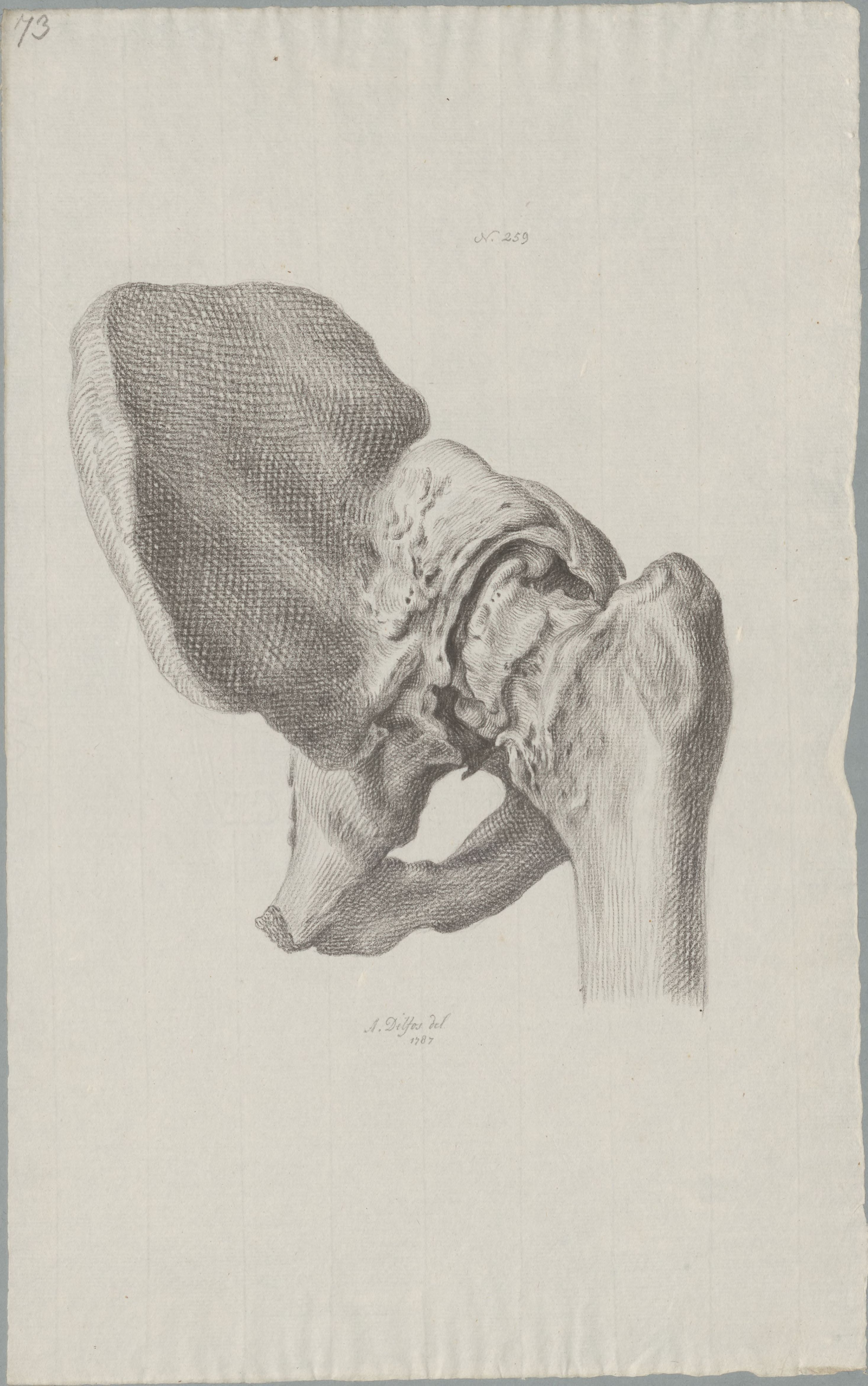 Specimens: pelvis
