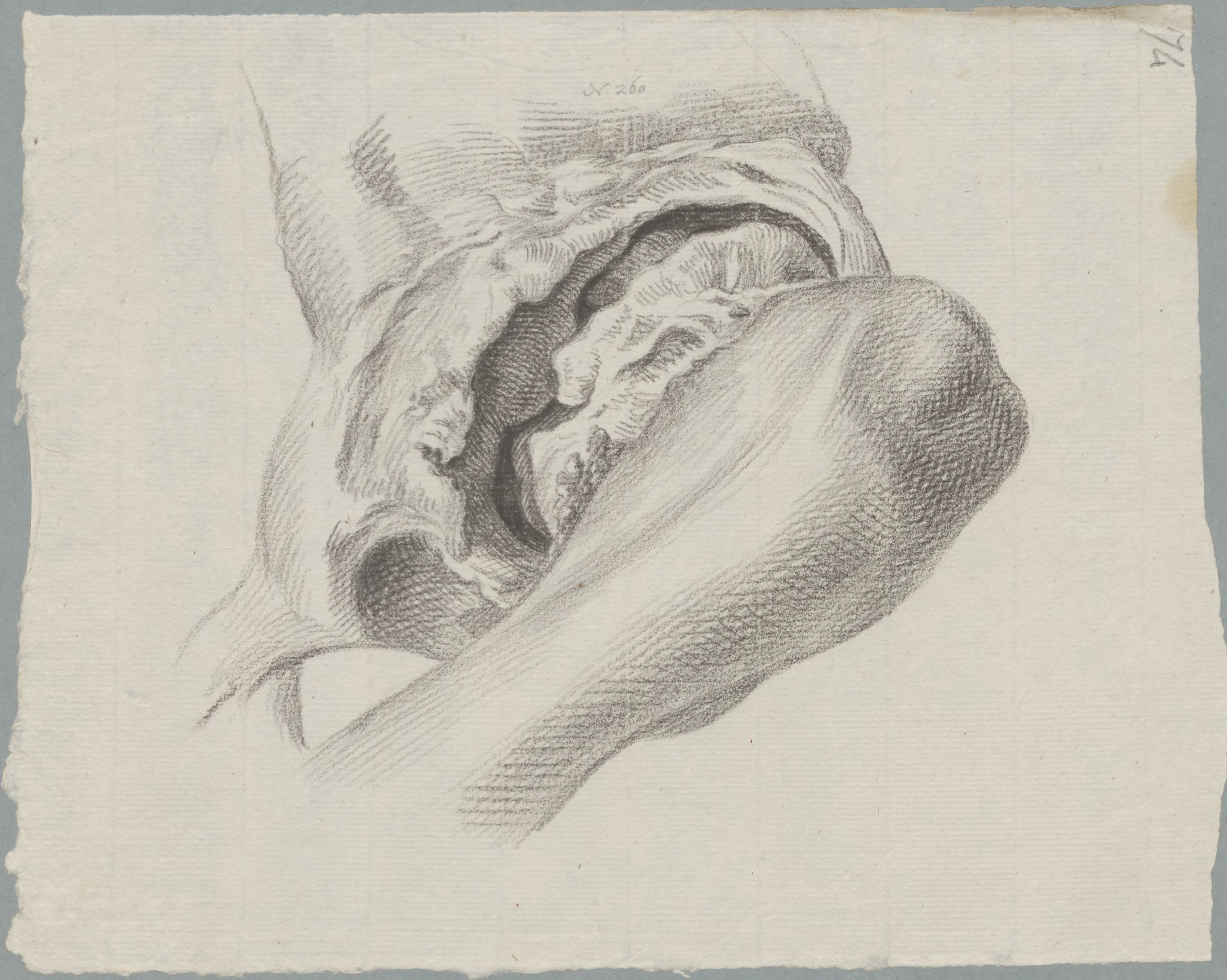 Specimens: pelvis, femur