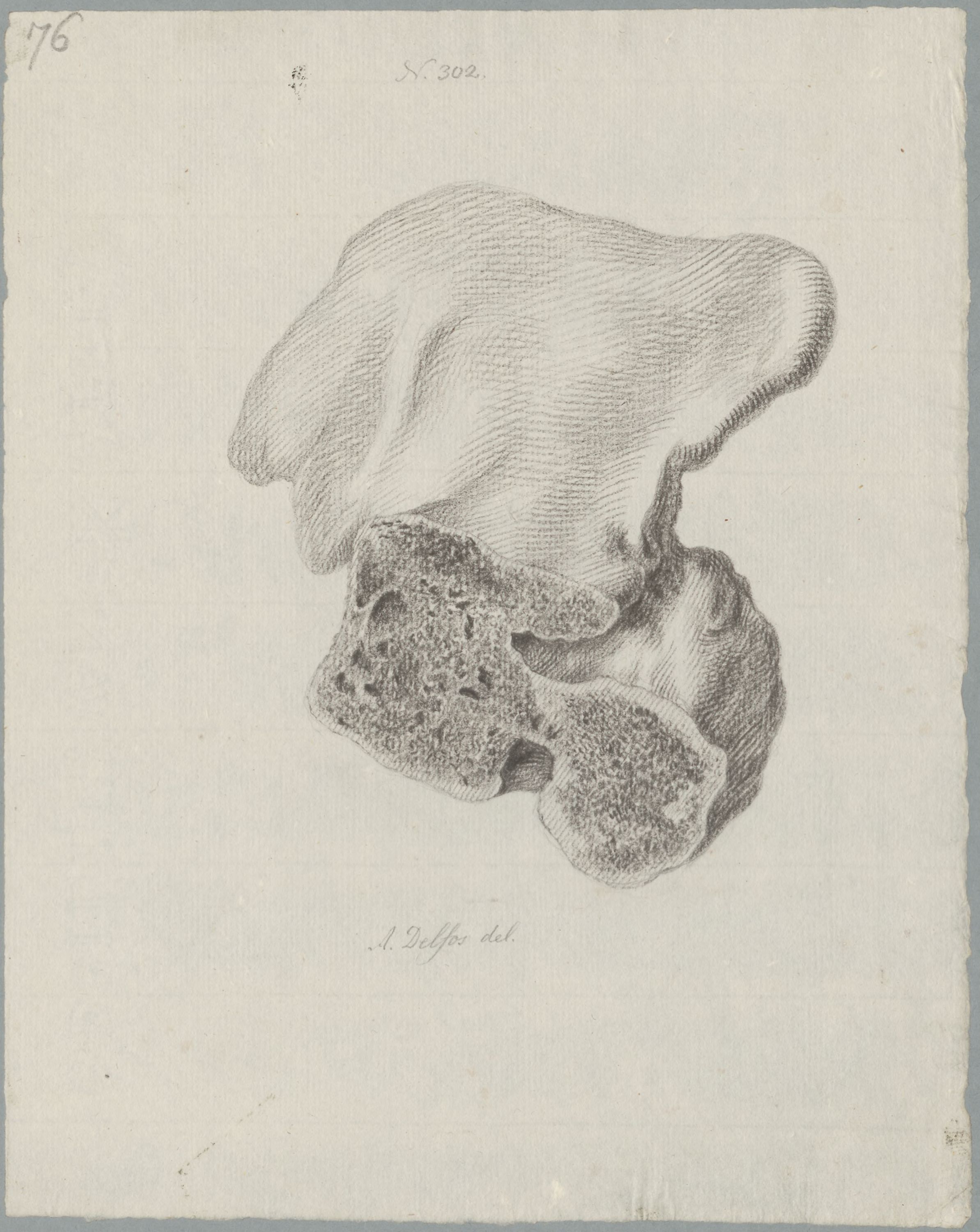 Specimens: pelvis, femur