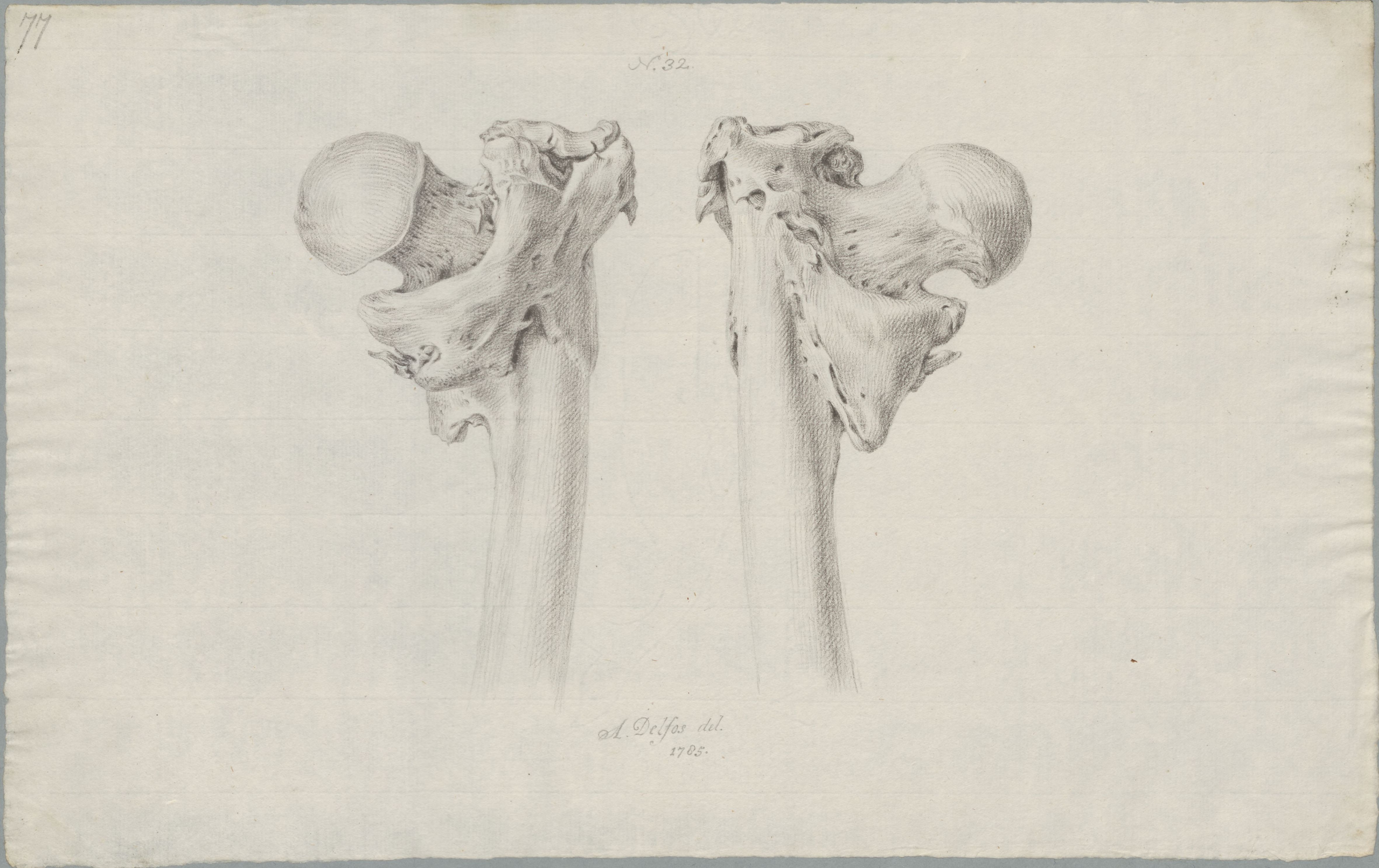 Specimens: femur