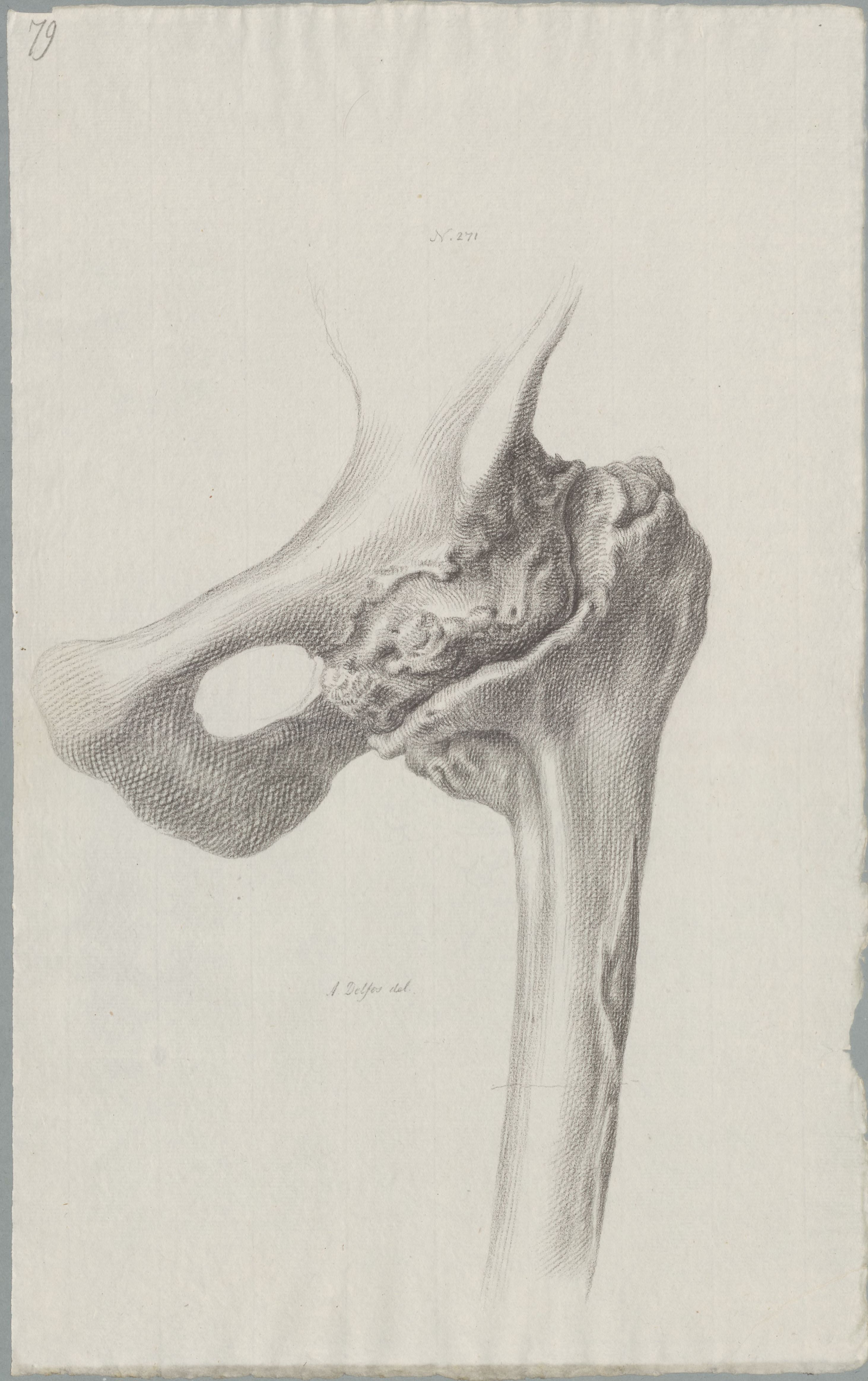 Specimens: pelvis, femur