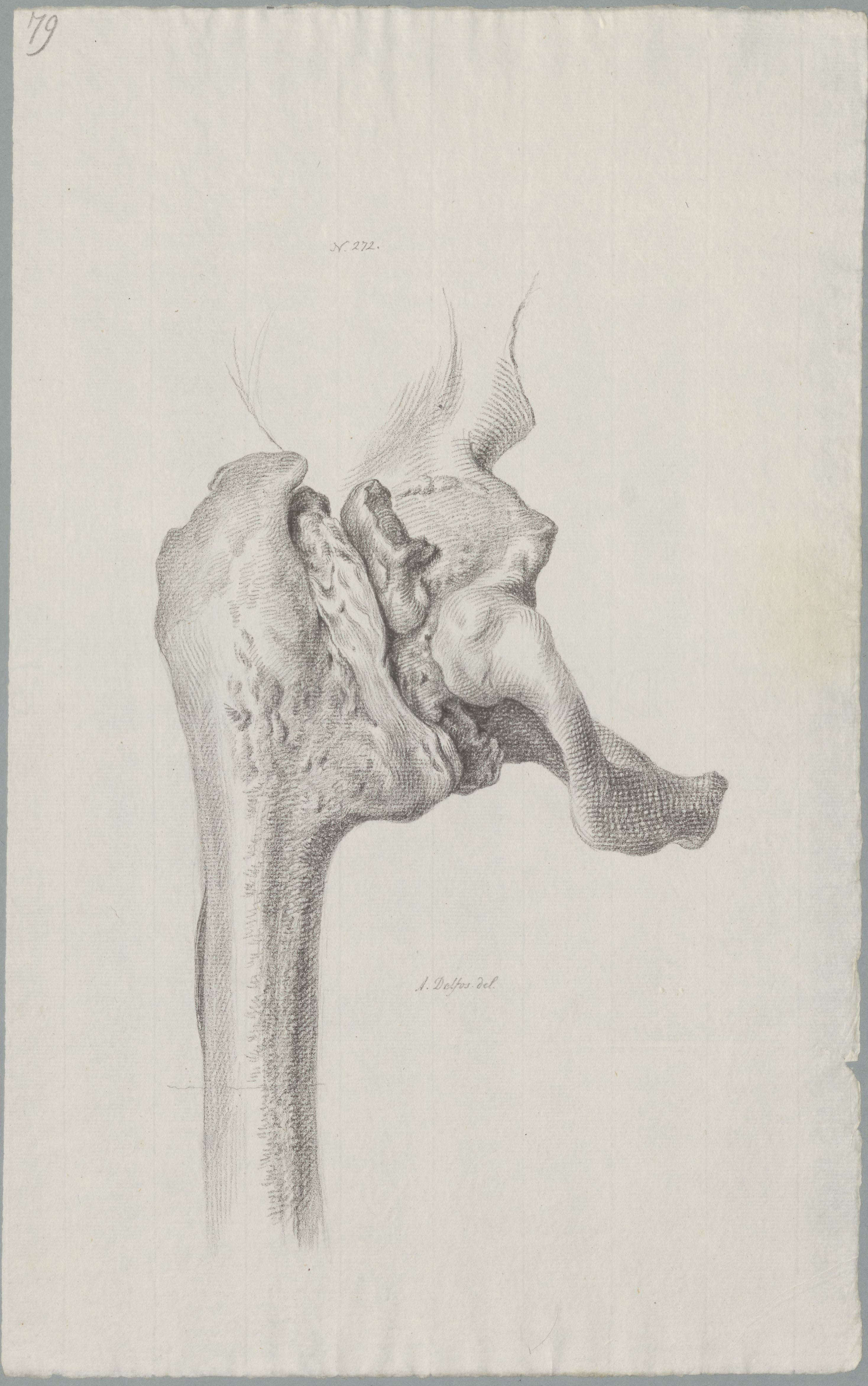 Specimens: pelvis, femur