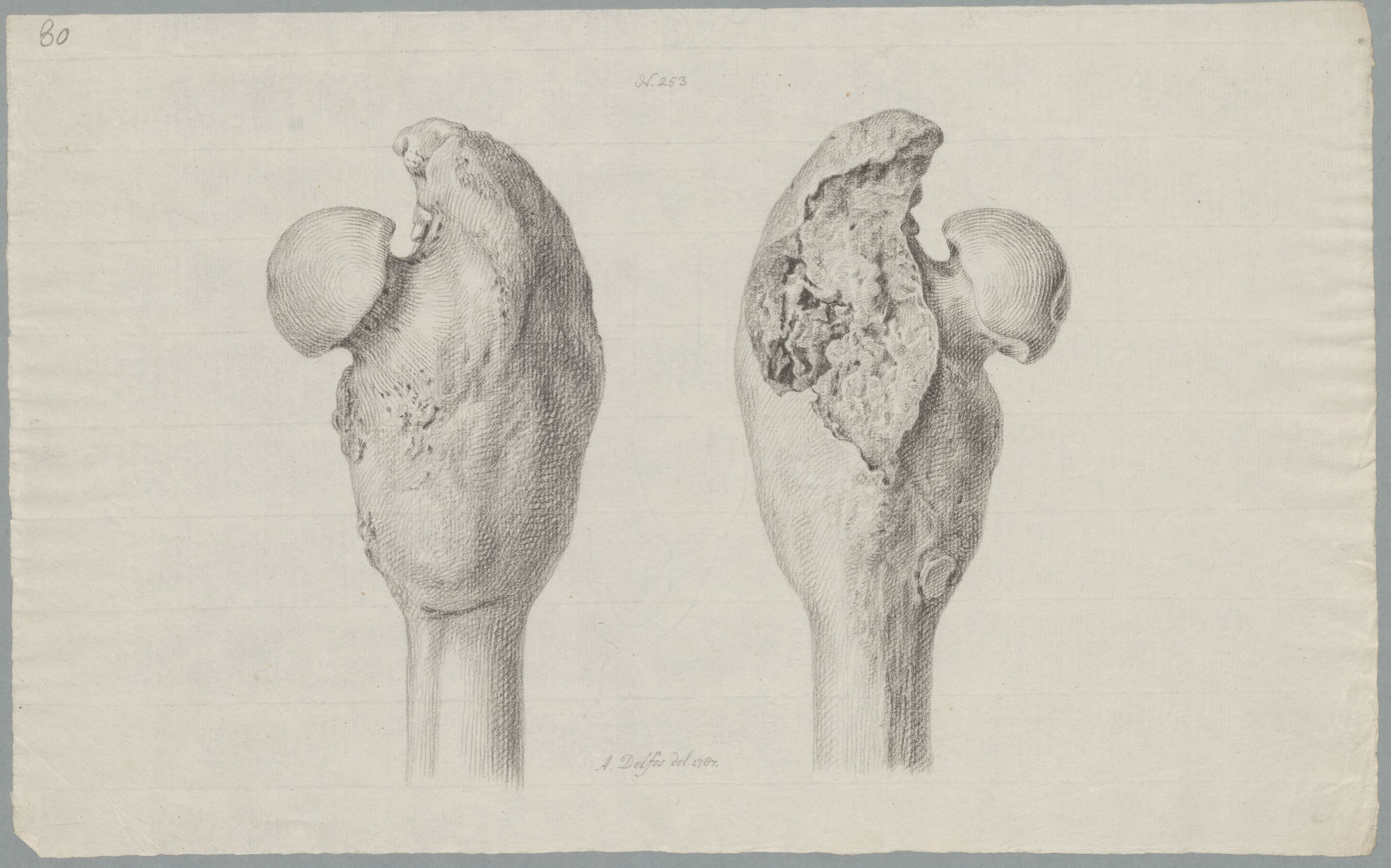 Specimens: femur