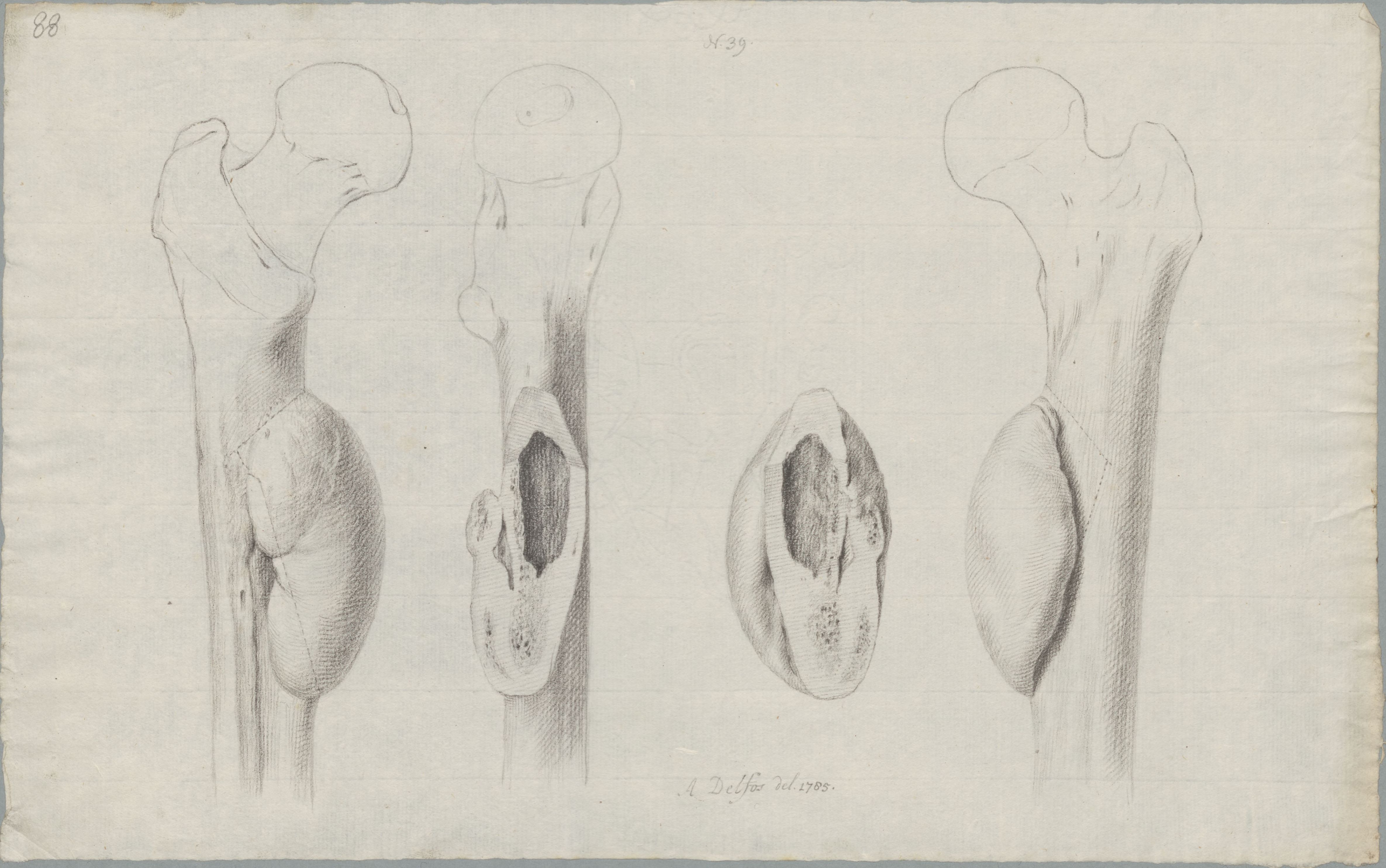 Specimens: femur