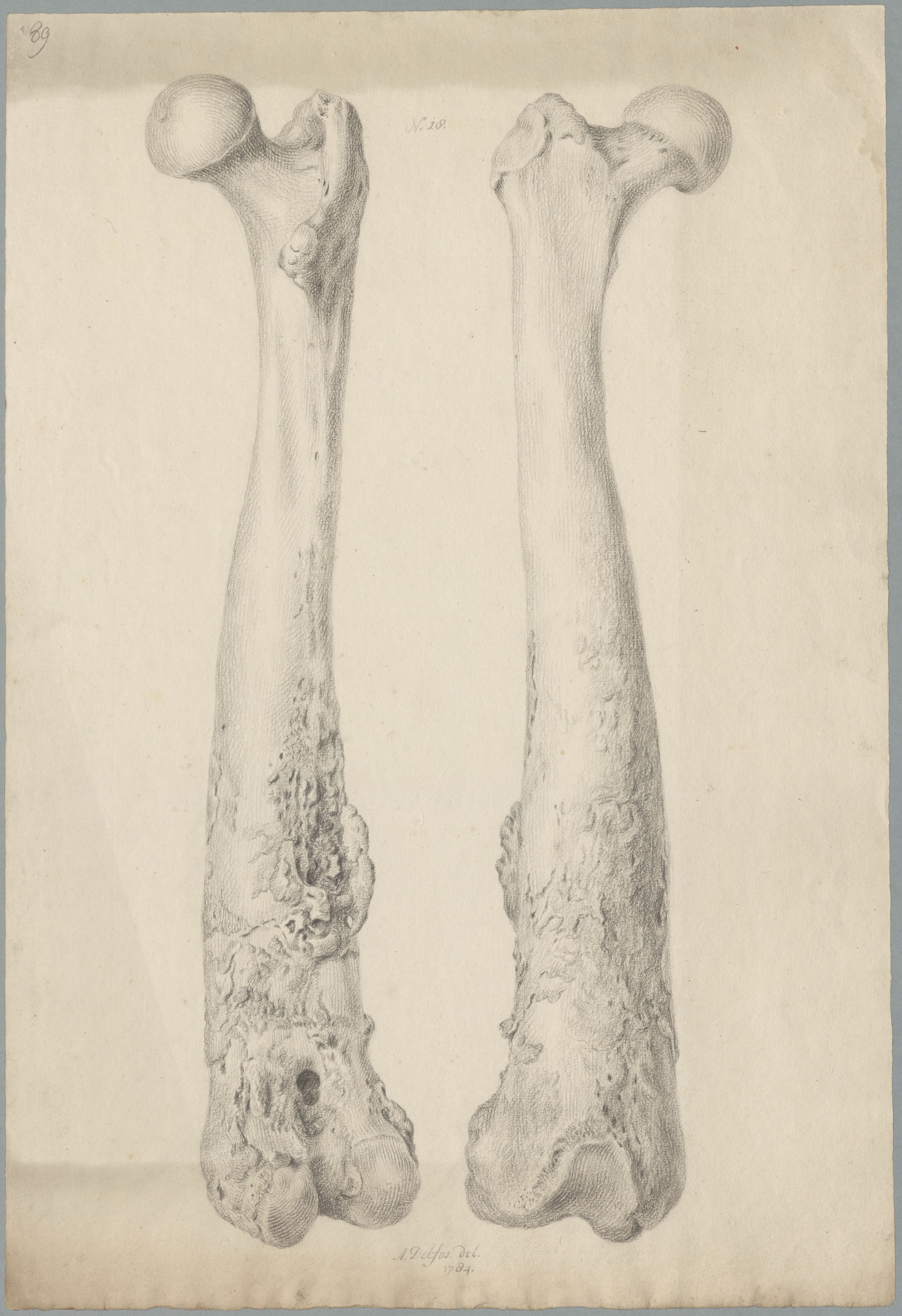 Specimens: femur