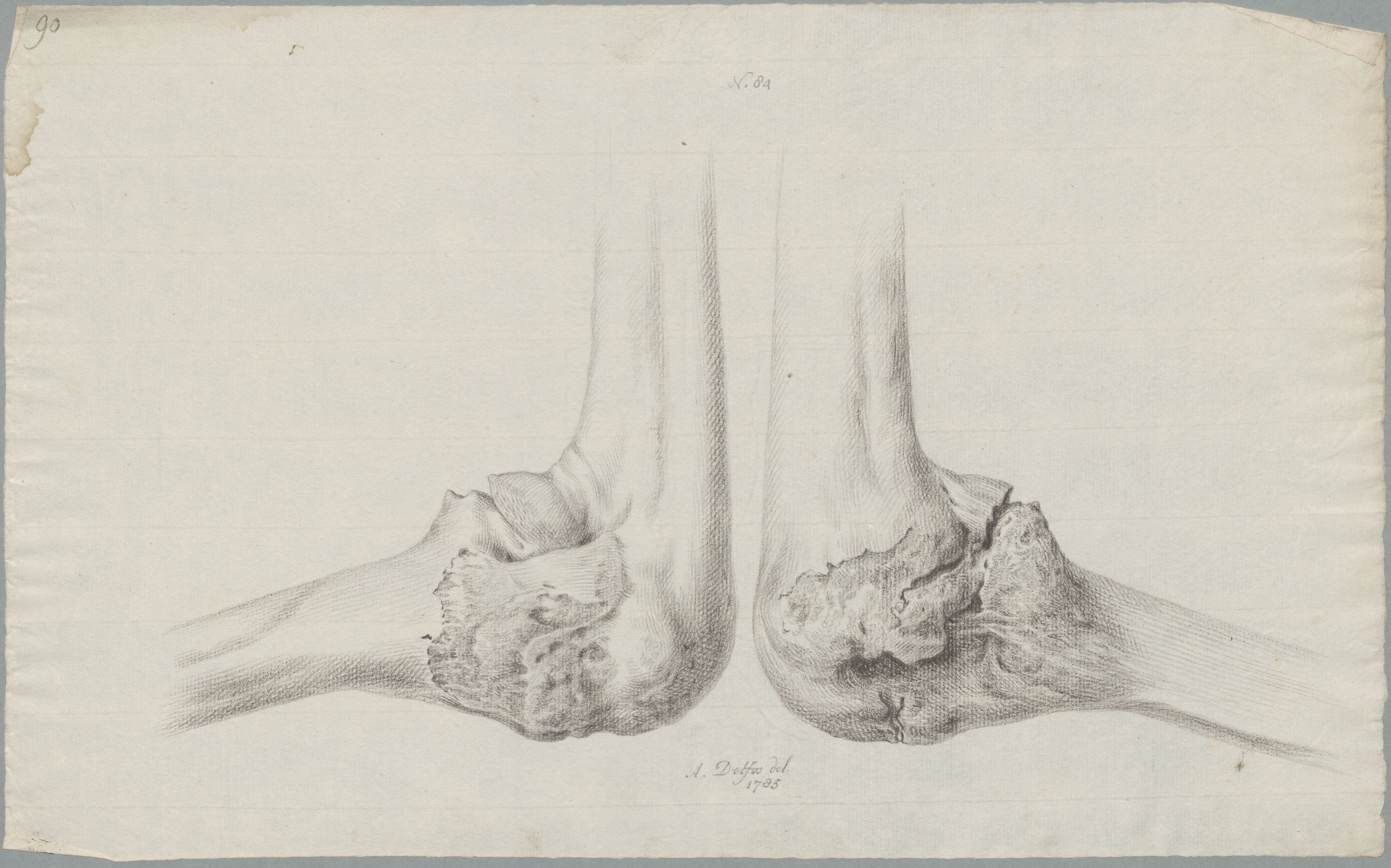 Specimens: femur