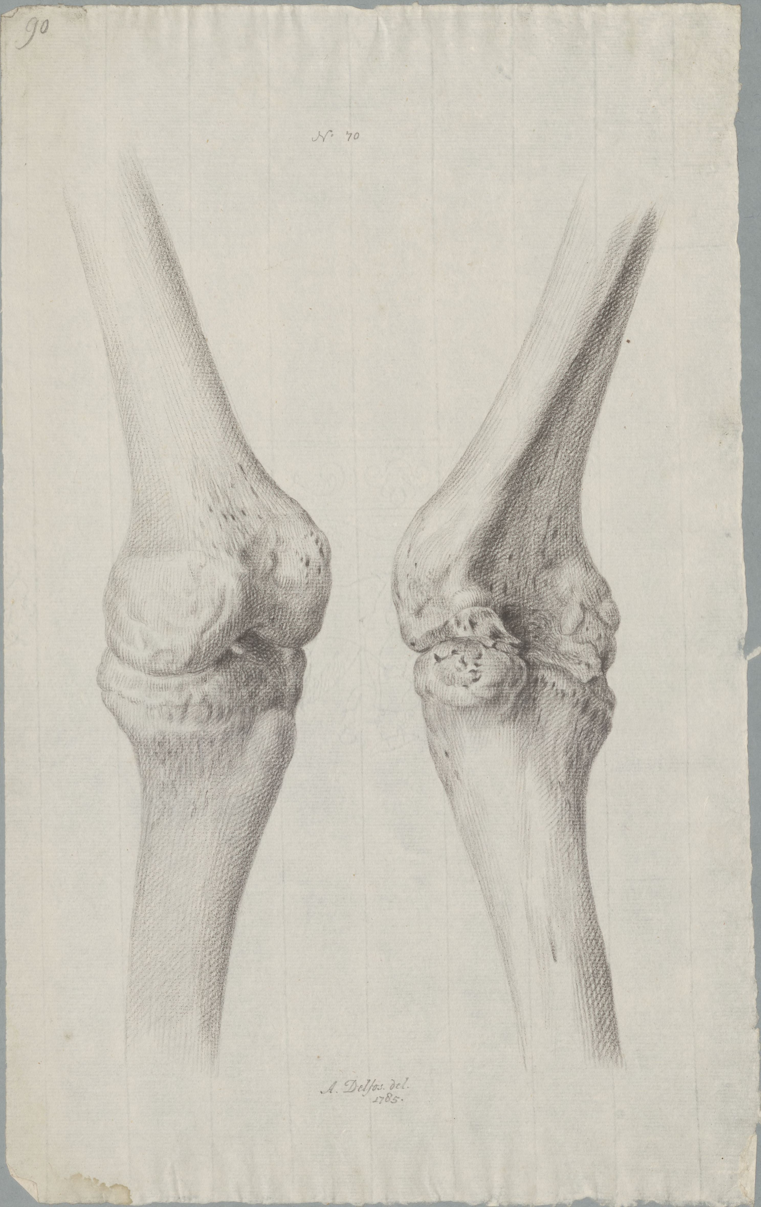 Specimens: femur
