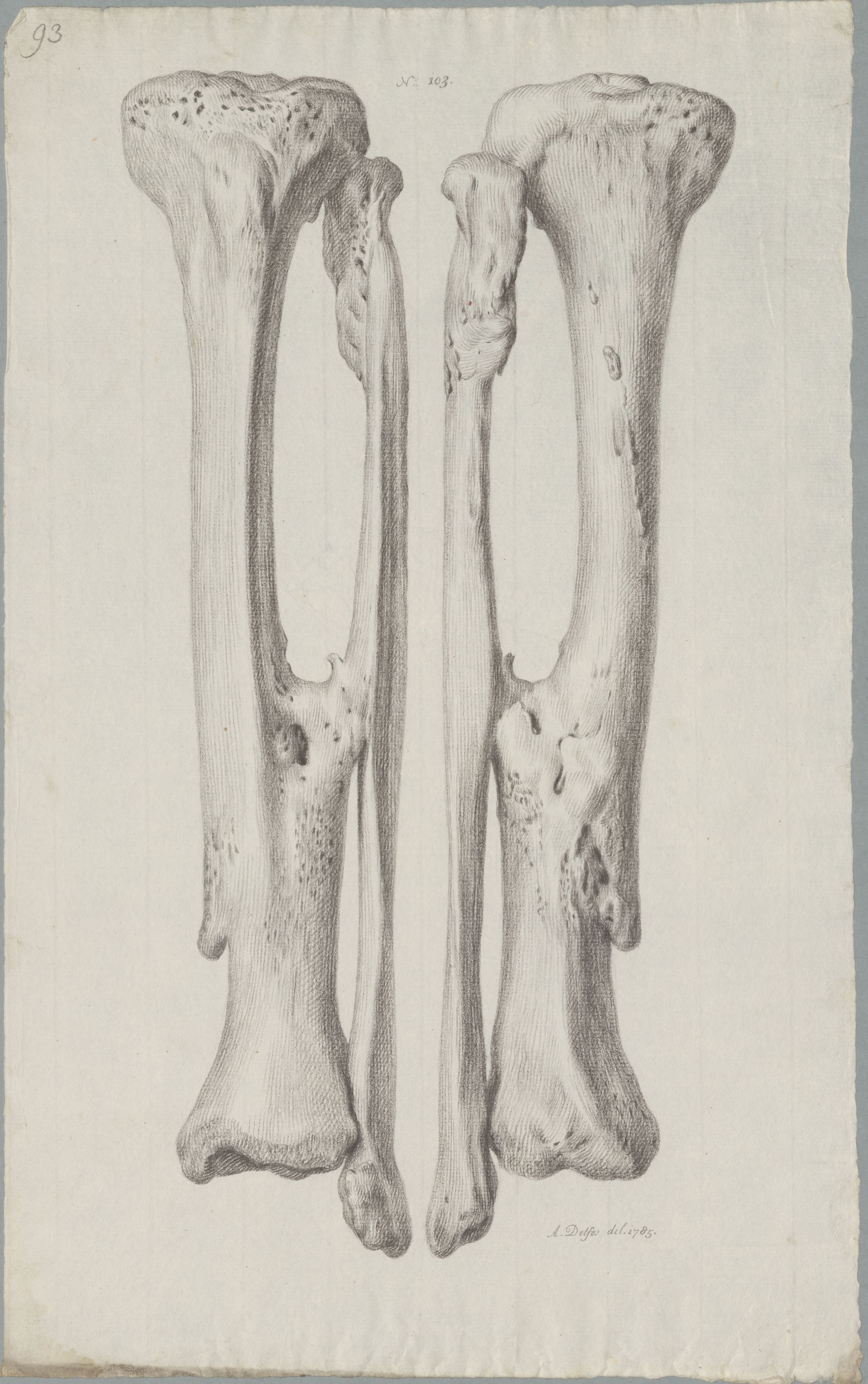 Specimens: tibia, fibula