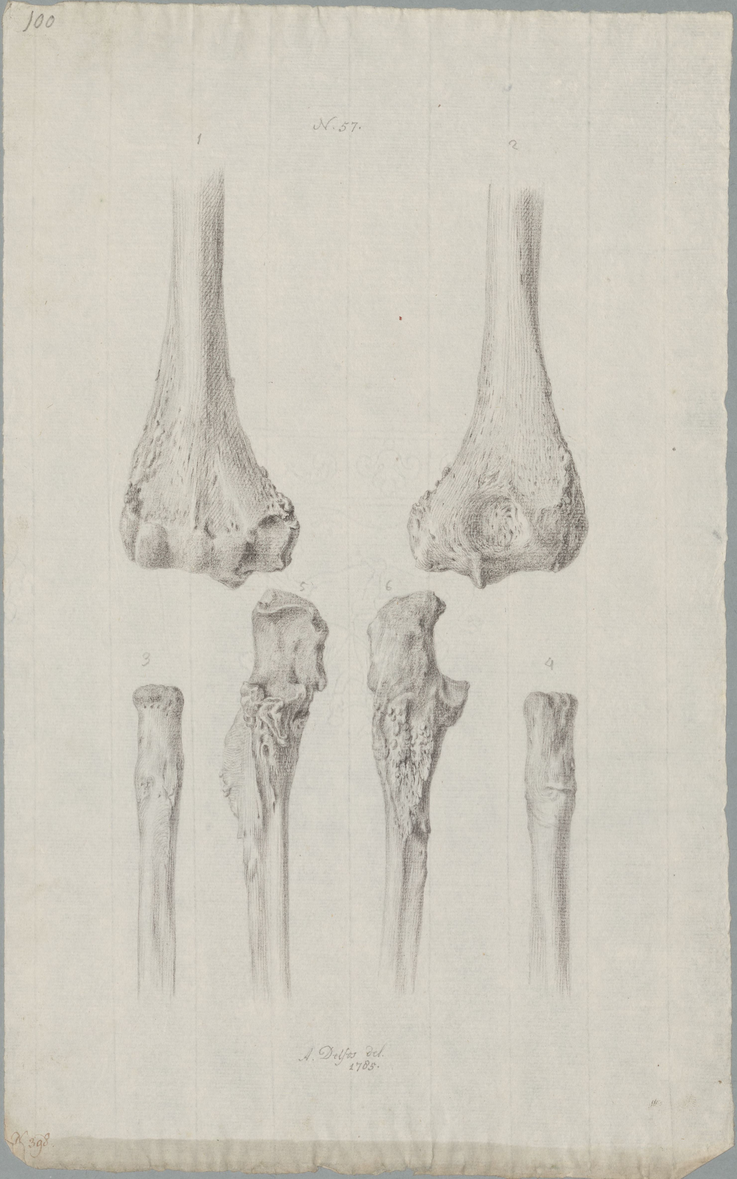 Specimens: humerus, ulna, radius