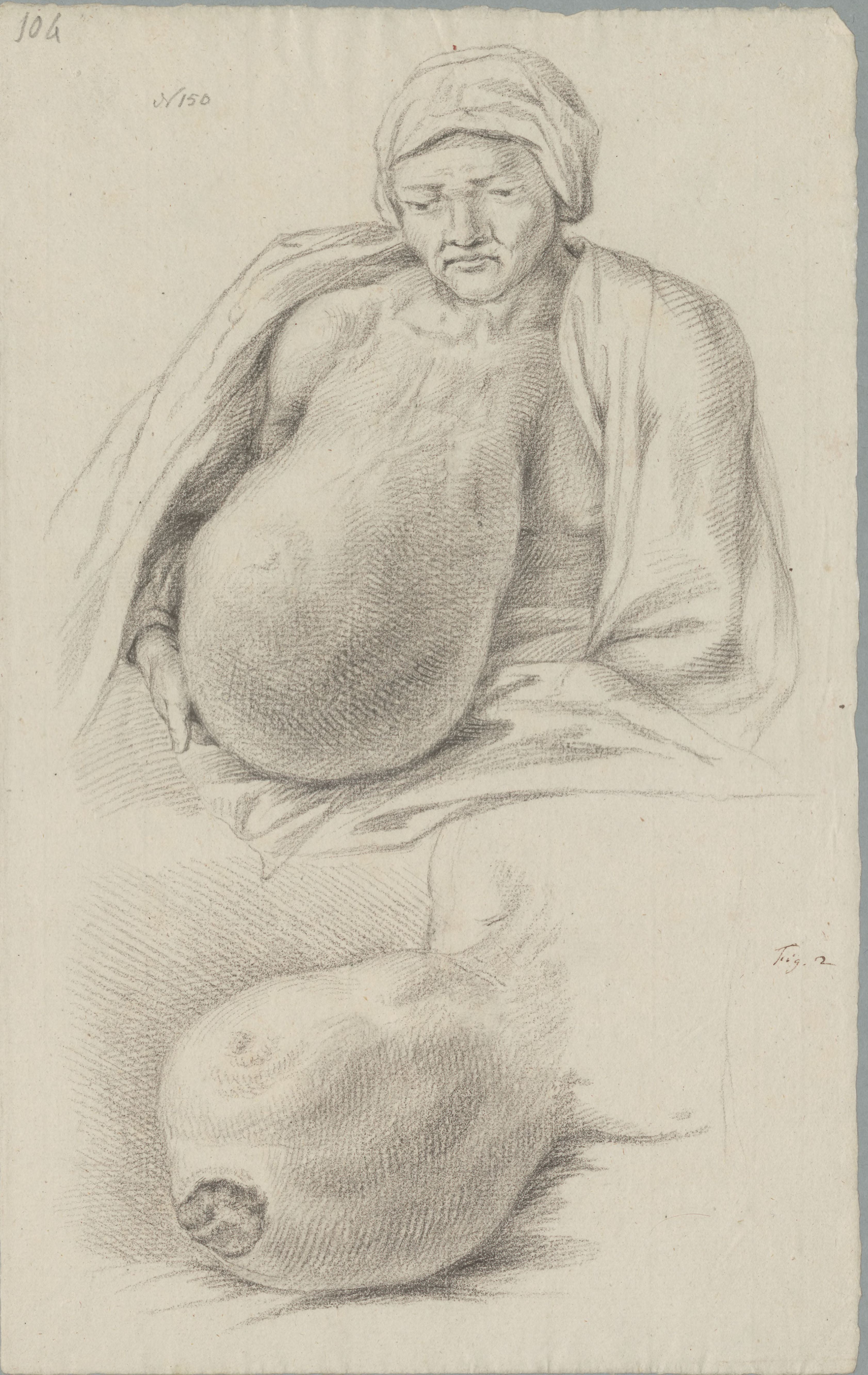 Specimens: mamma