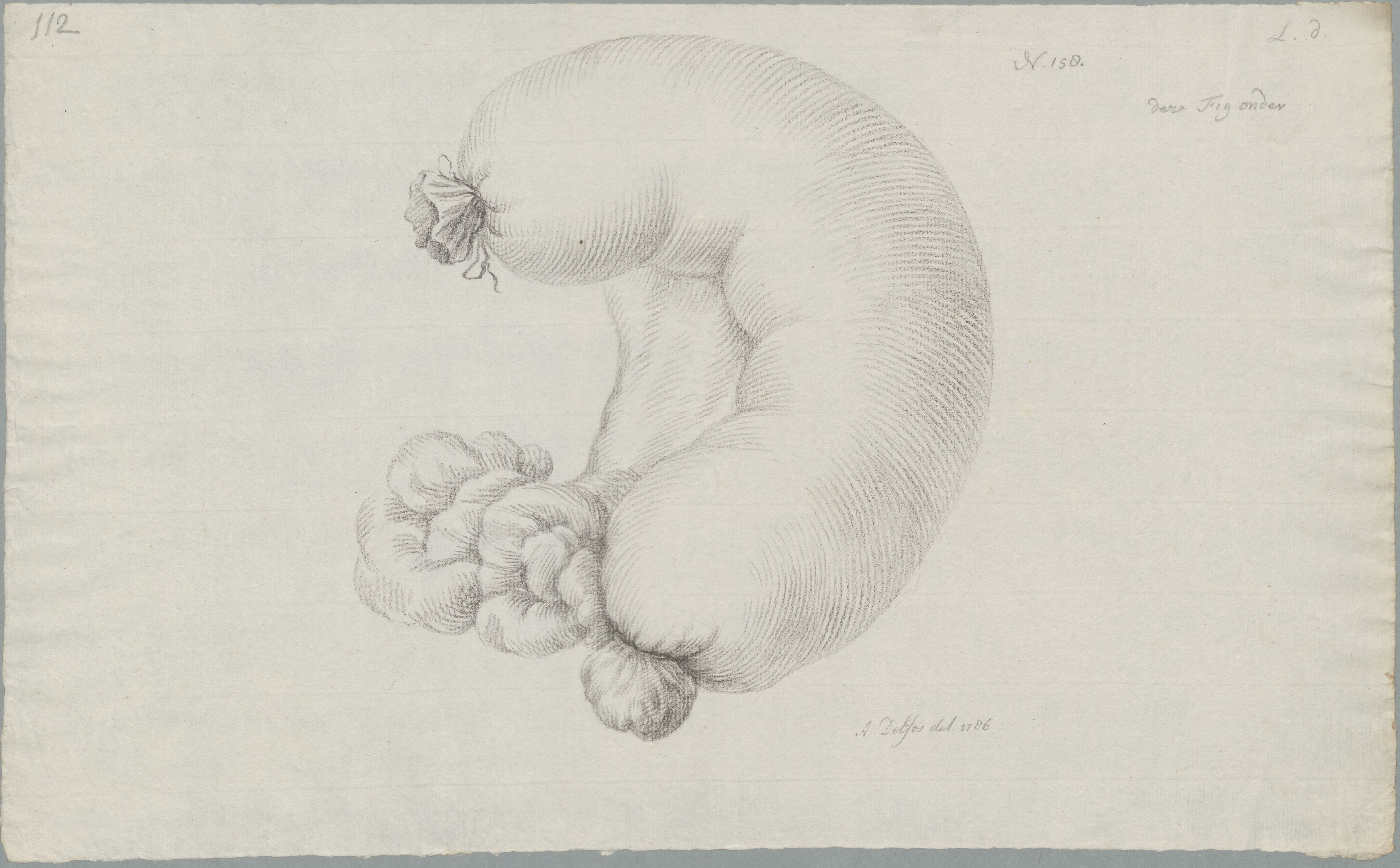 Specimens: abdomen, genitals