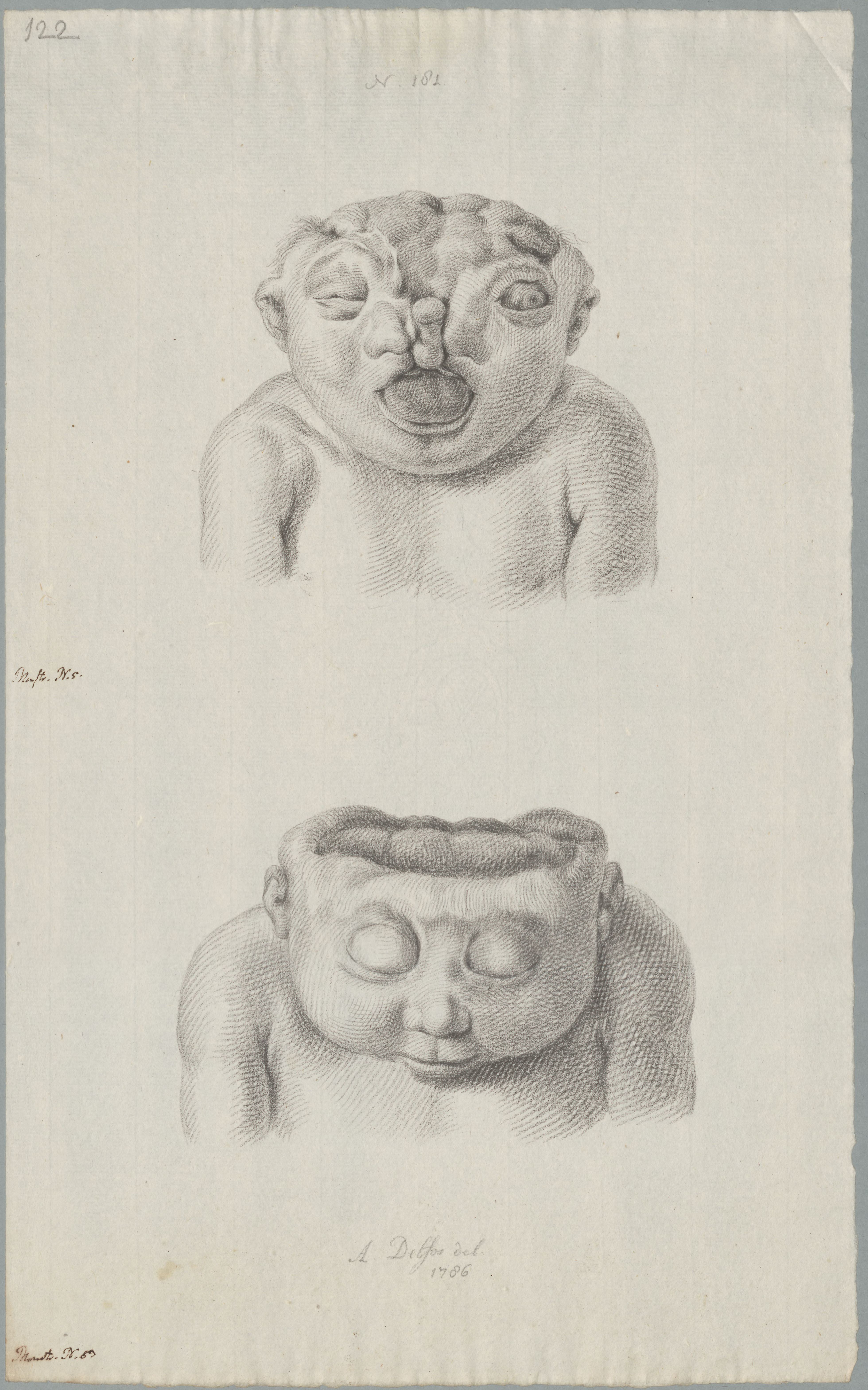 Specimens: deformity