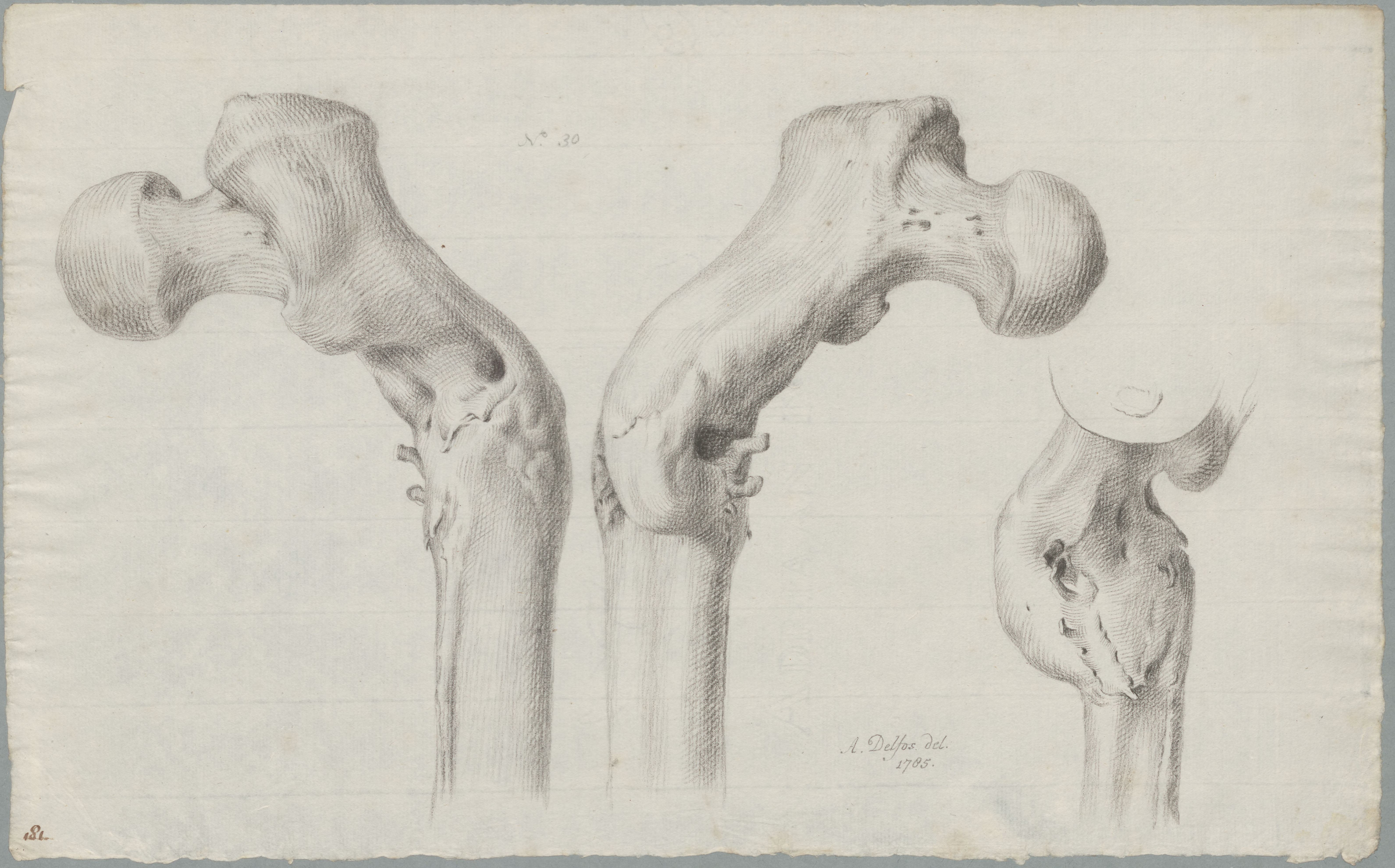 Specimens: bone, three views