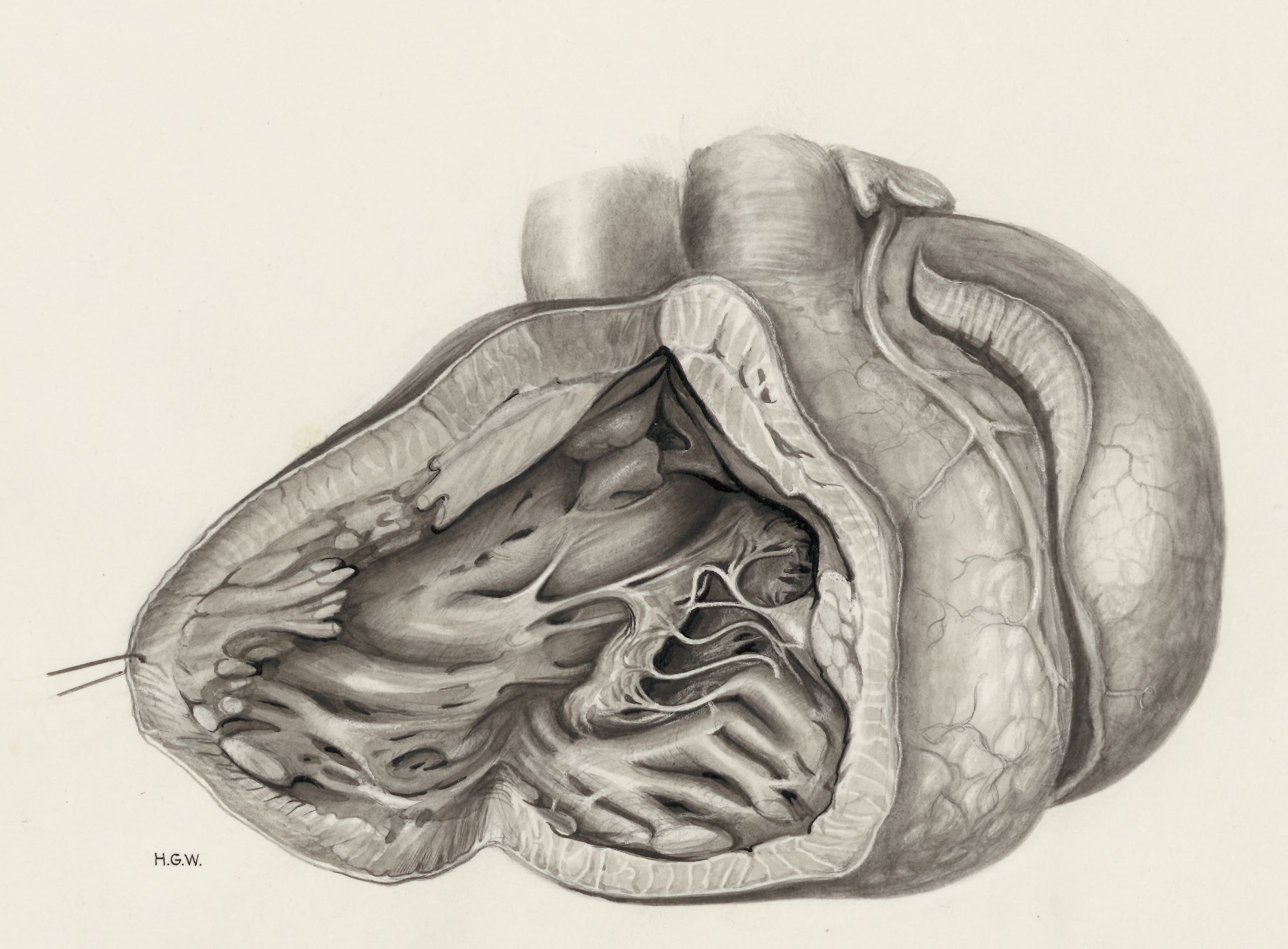 Heart