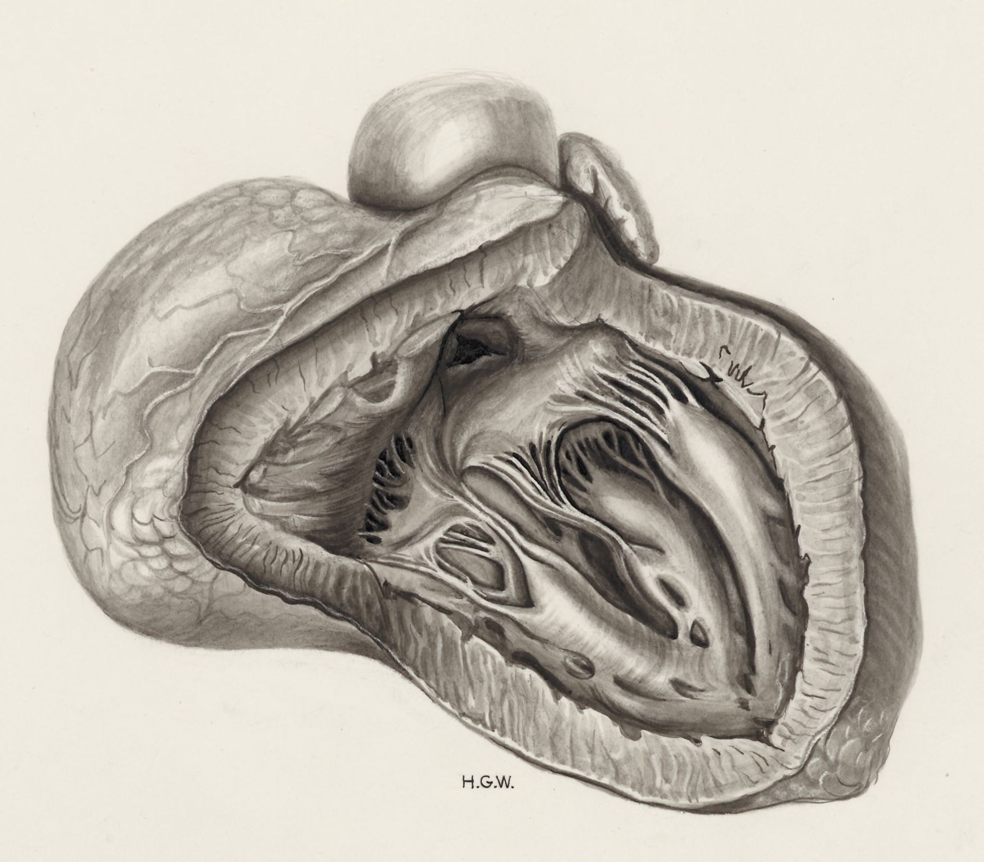 Heart