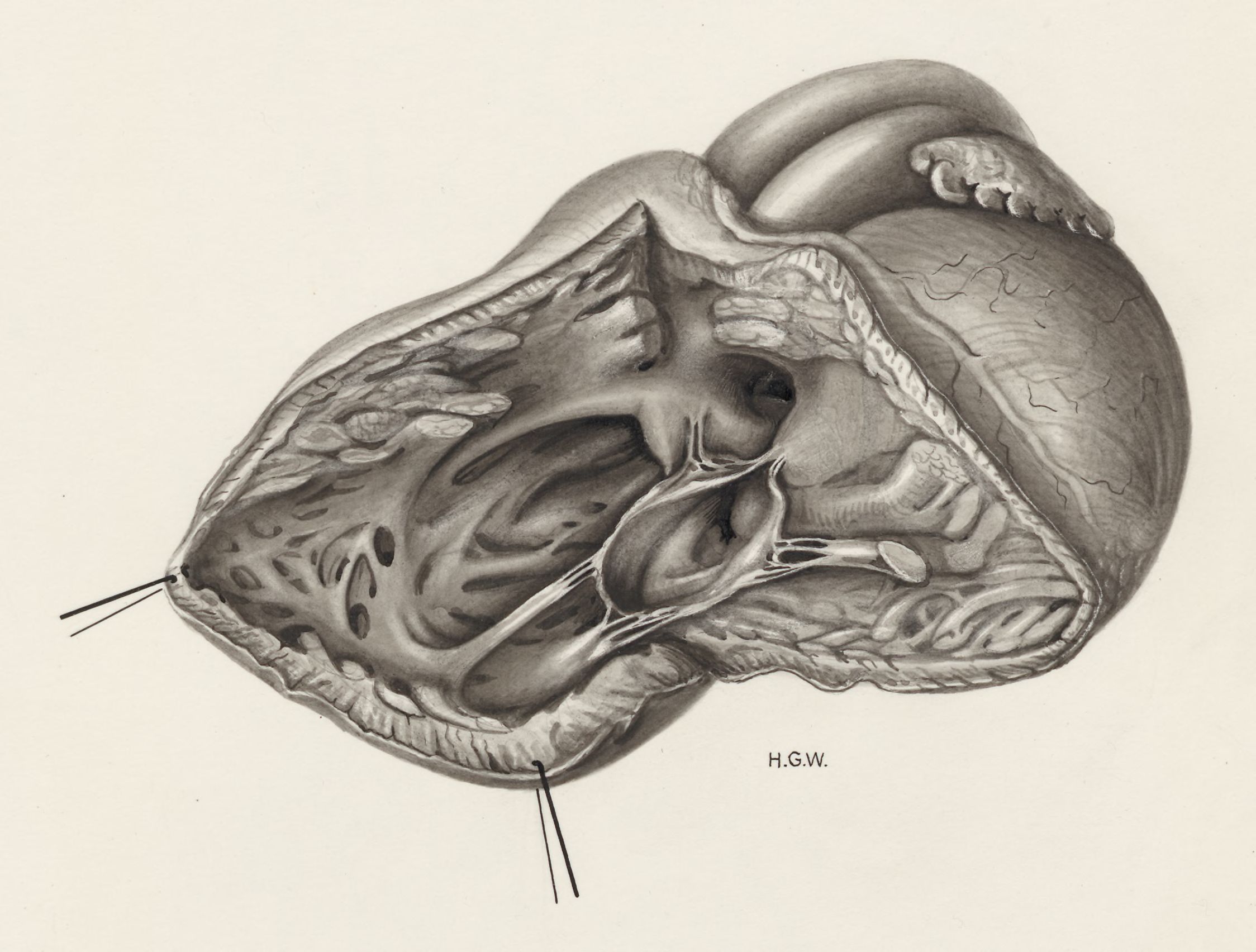 Heart