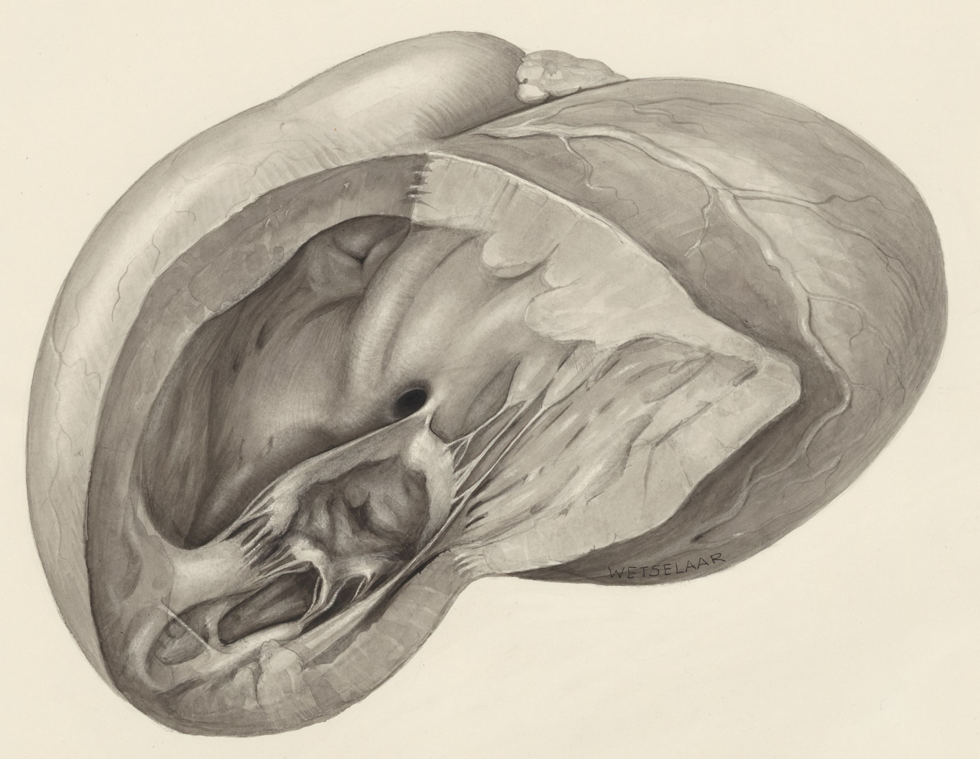 Heart