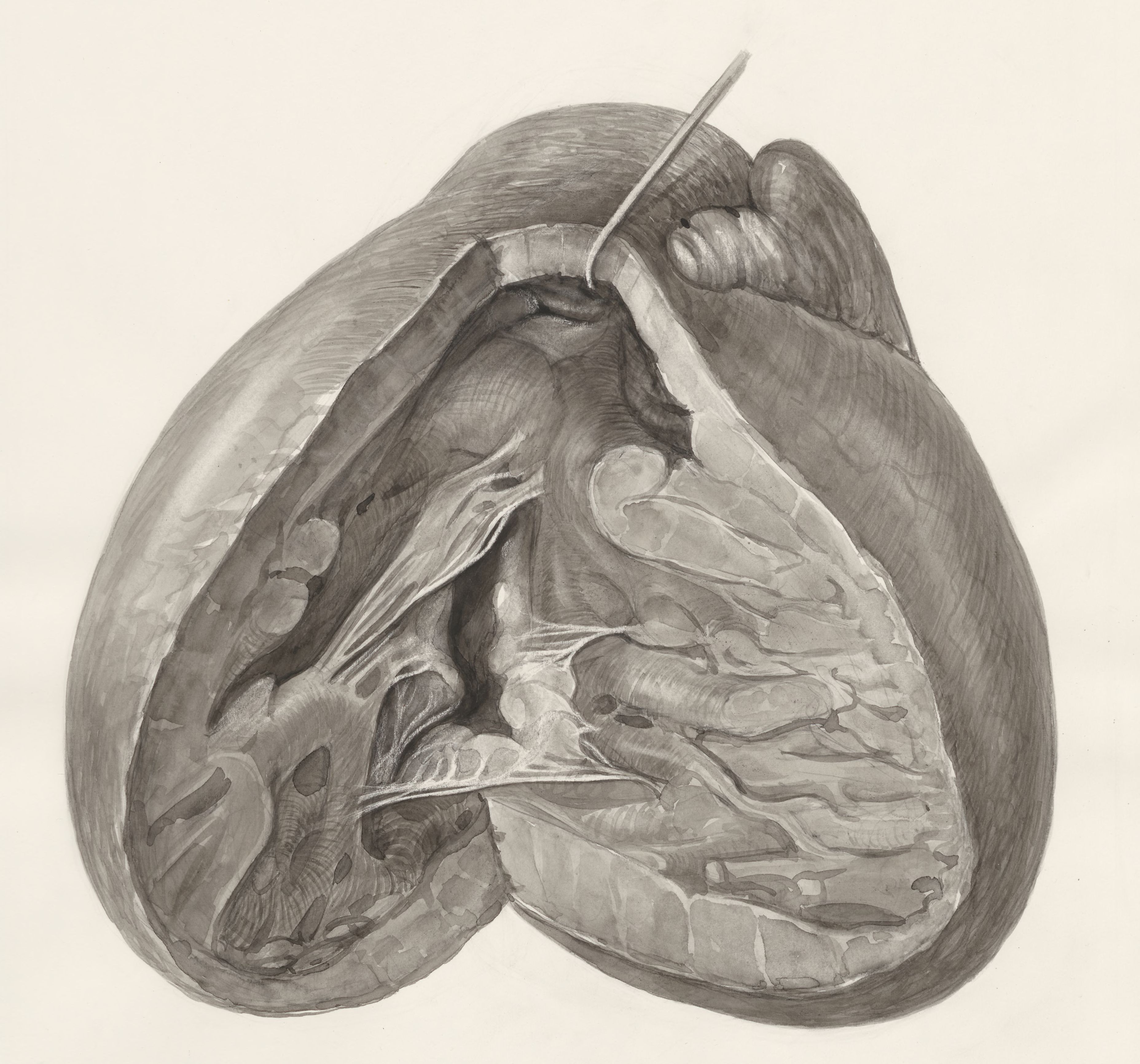 Heart