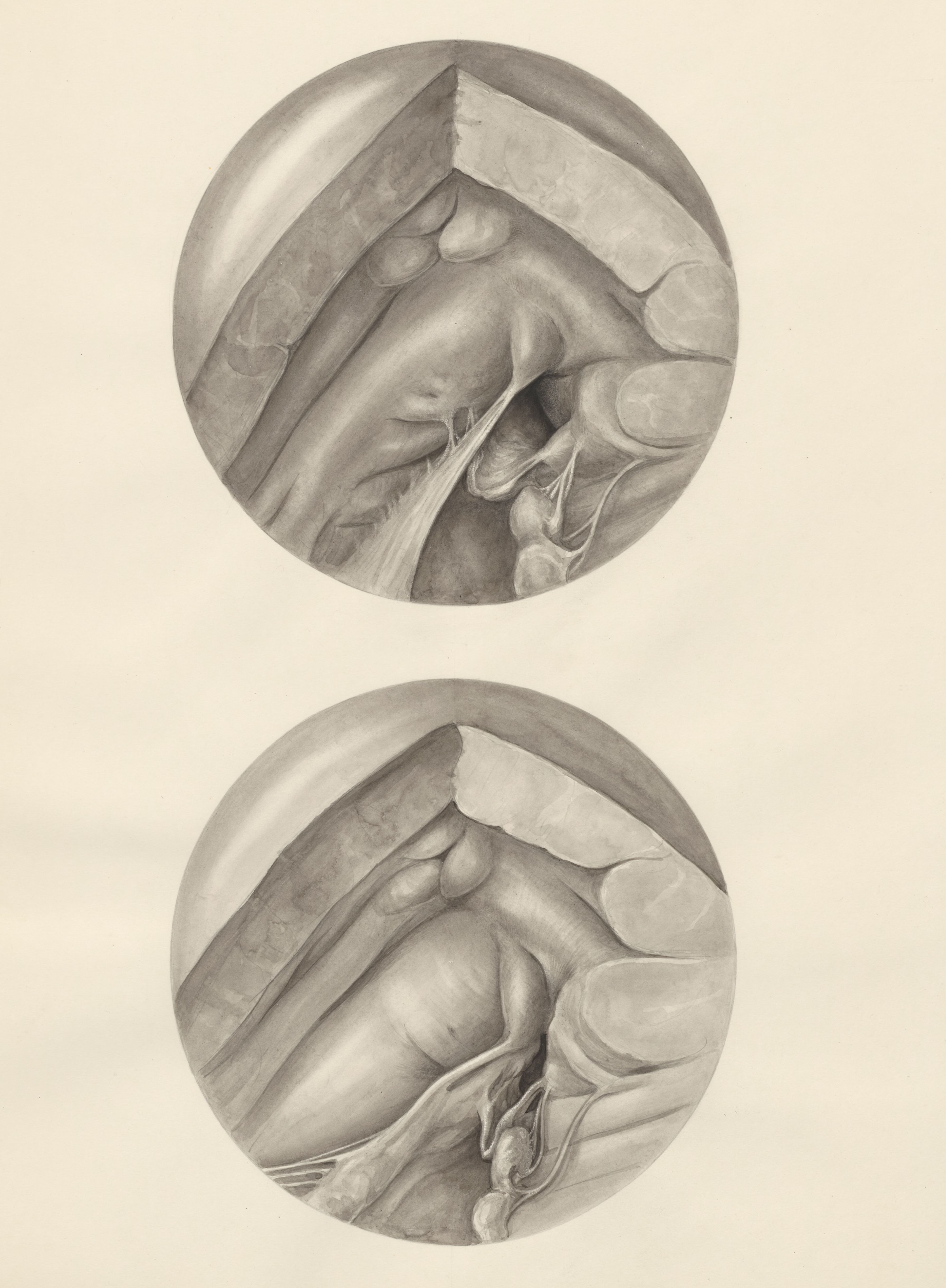 Two microscopic magnifications of parts of the heart