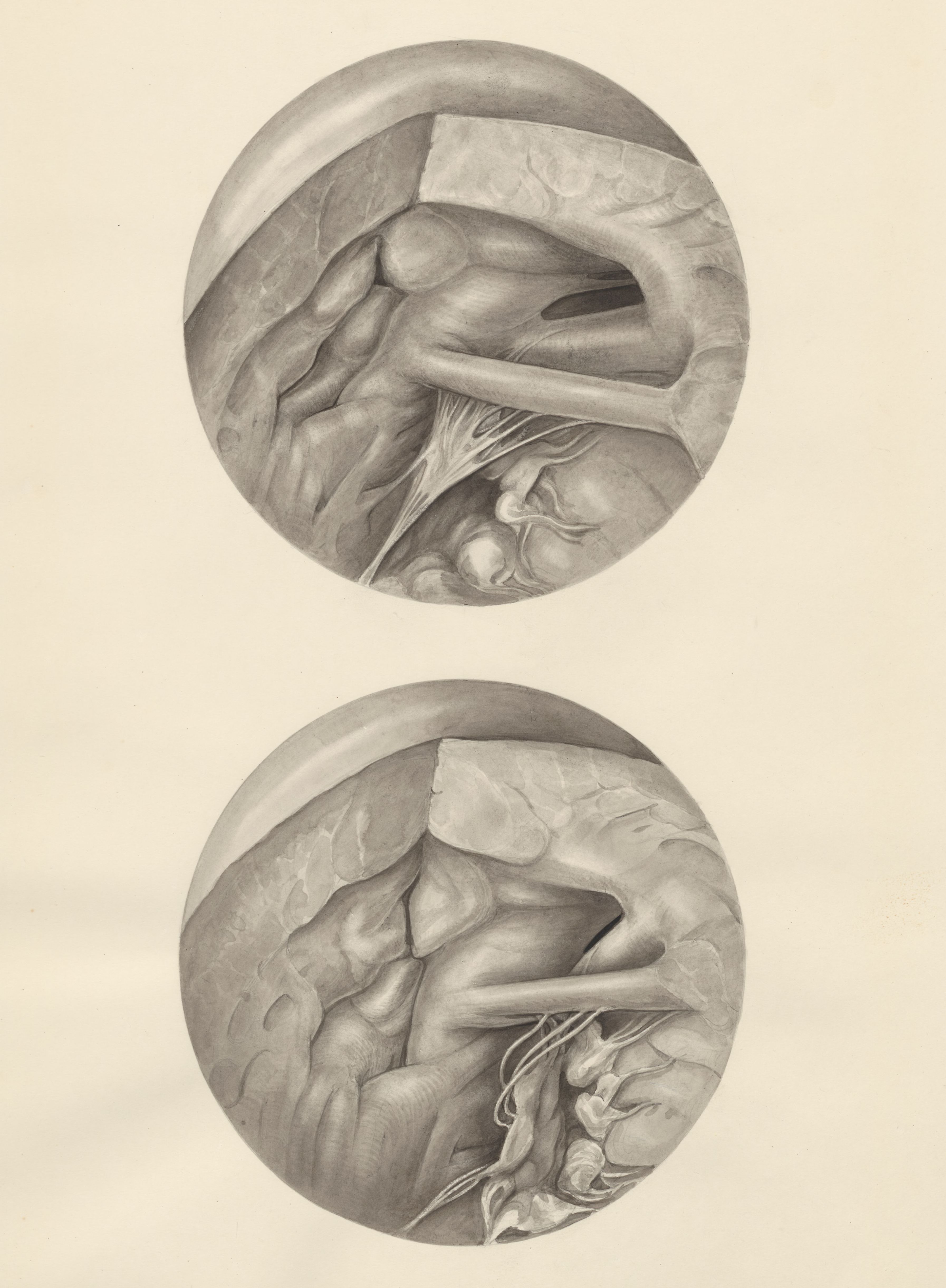 Two microscopic magnifications of parts of the heart
