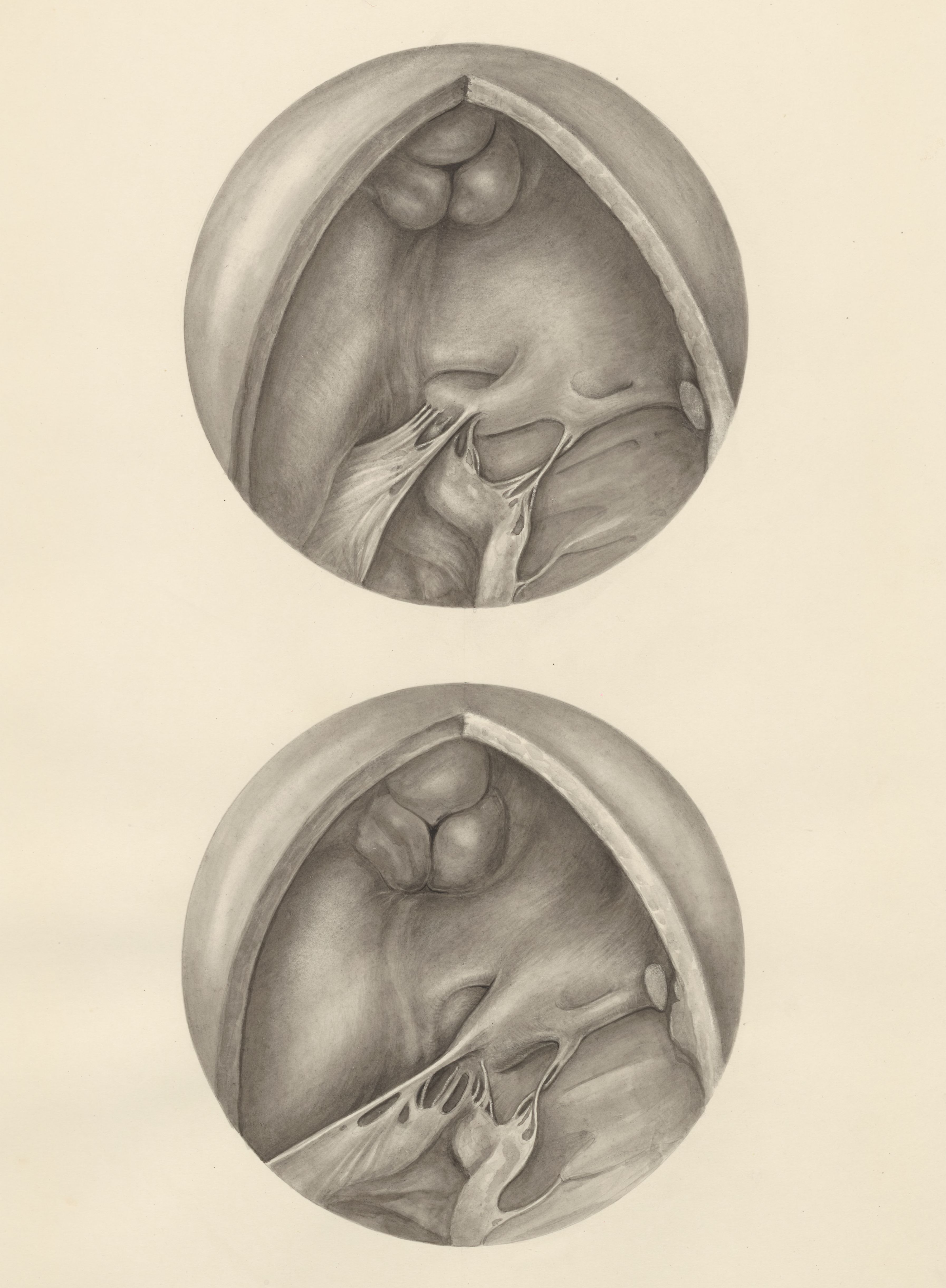Two microscopic magnifications of parts of the heart