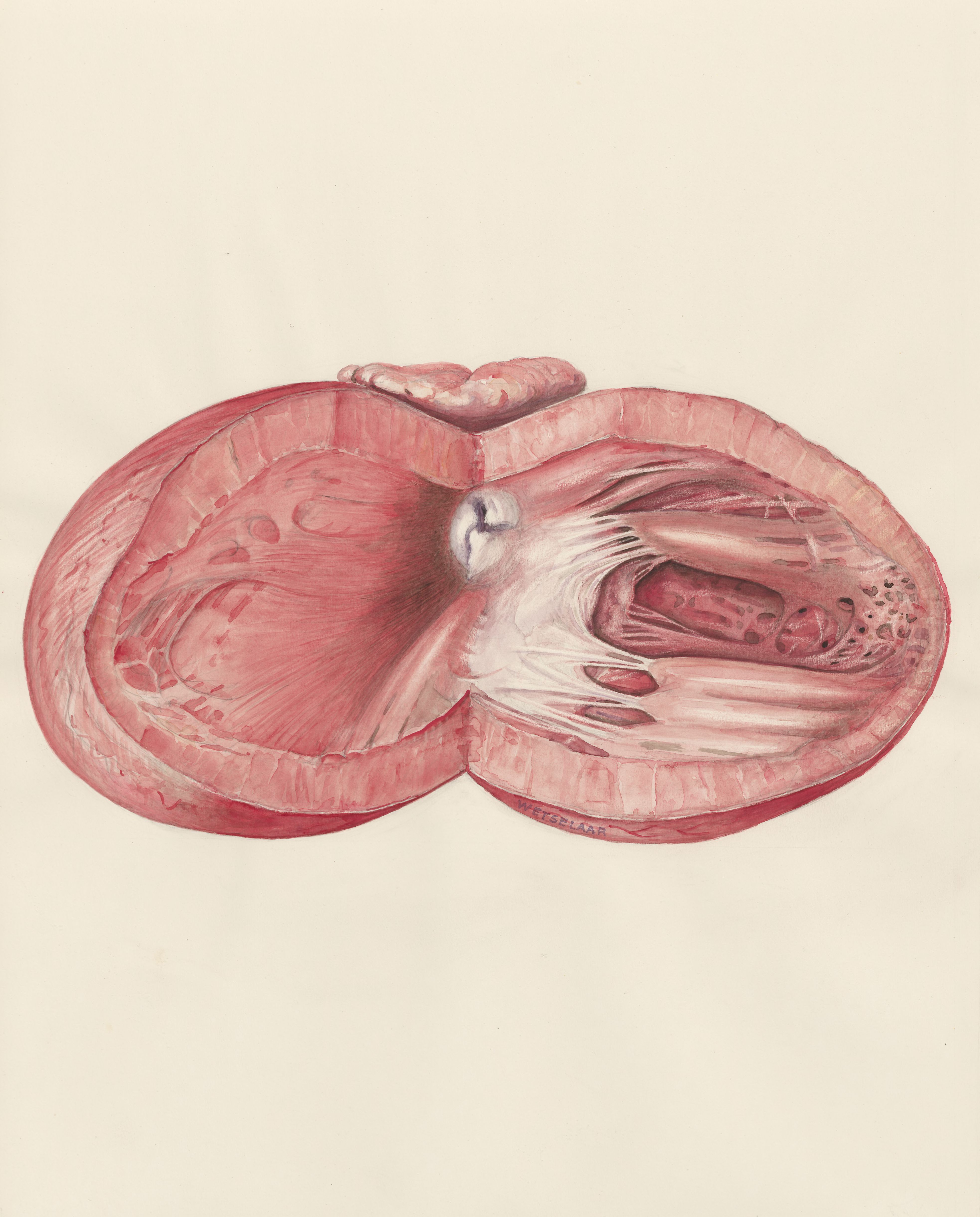 Heart