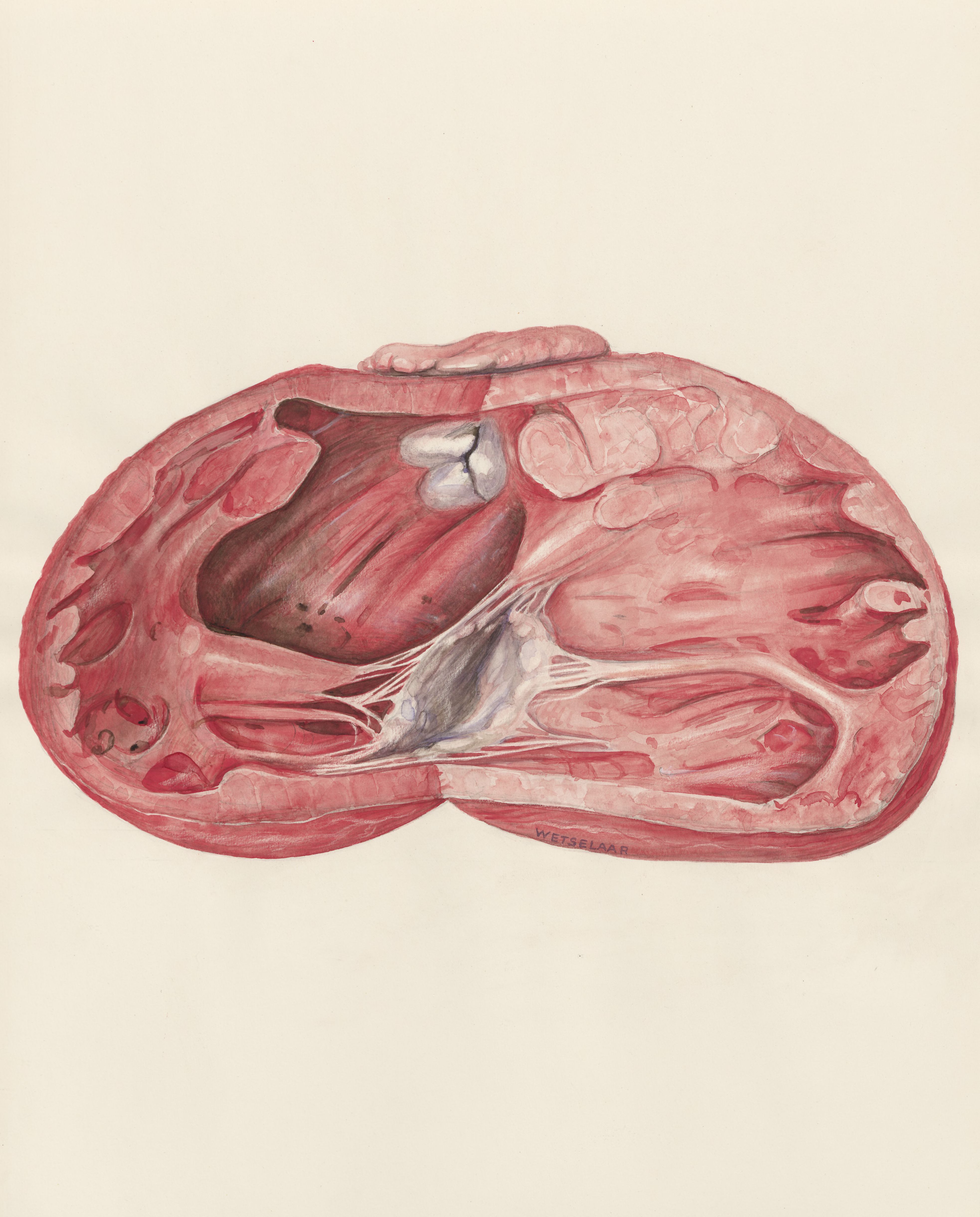 Heart