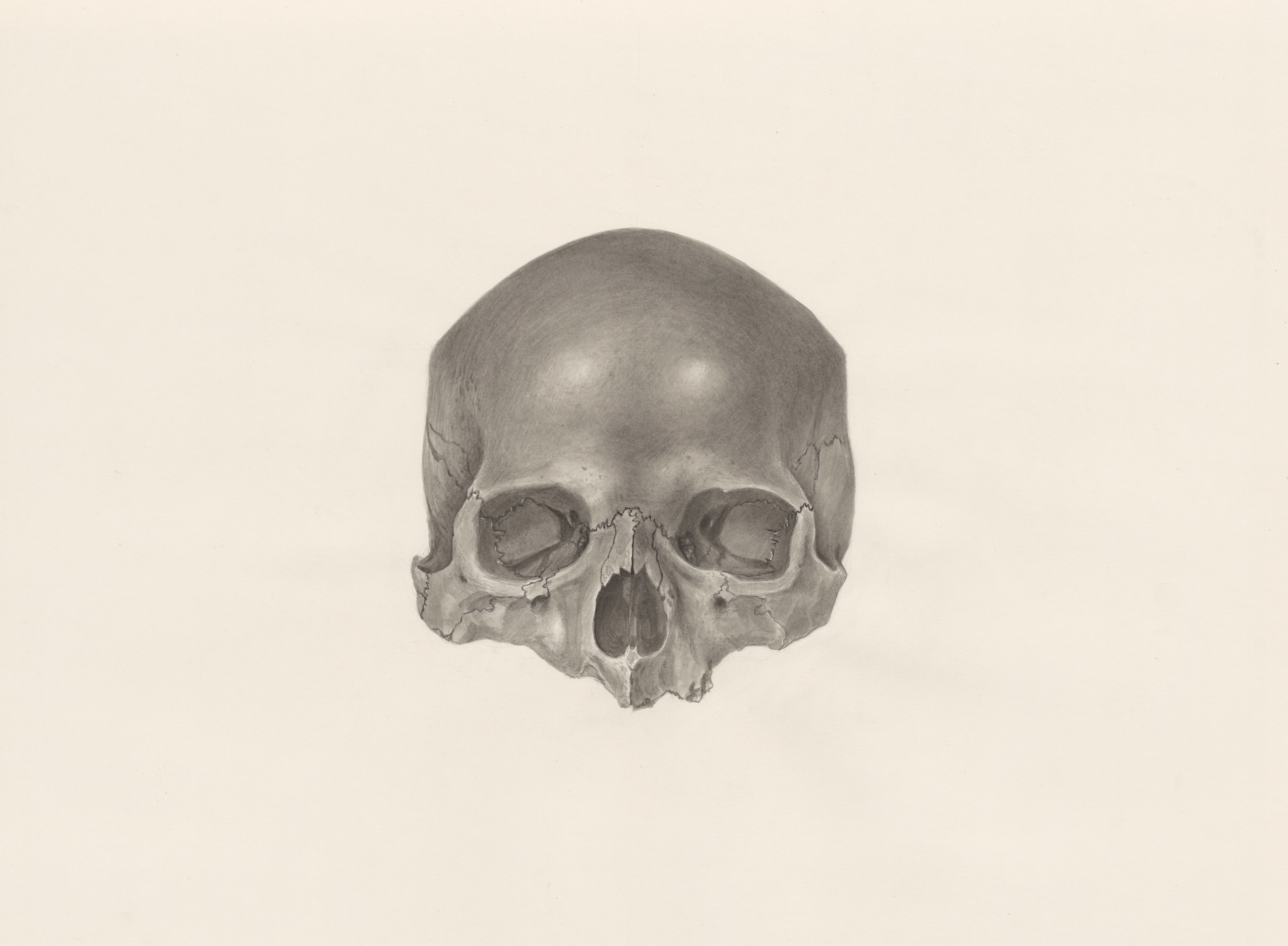 Deformed skull