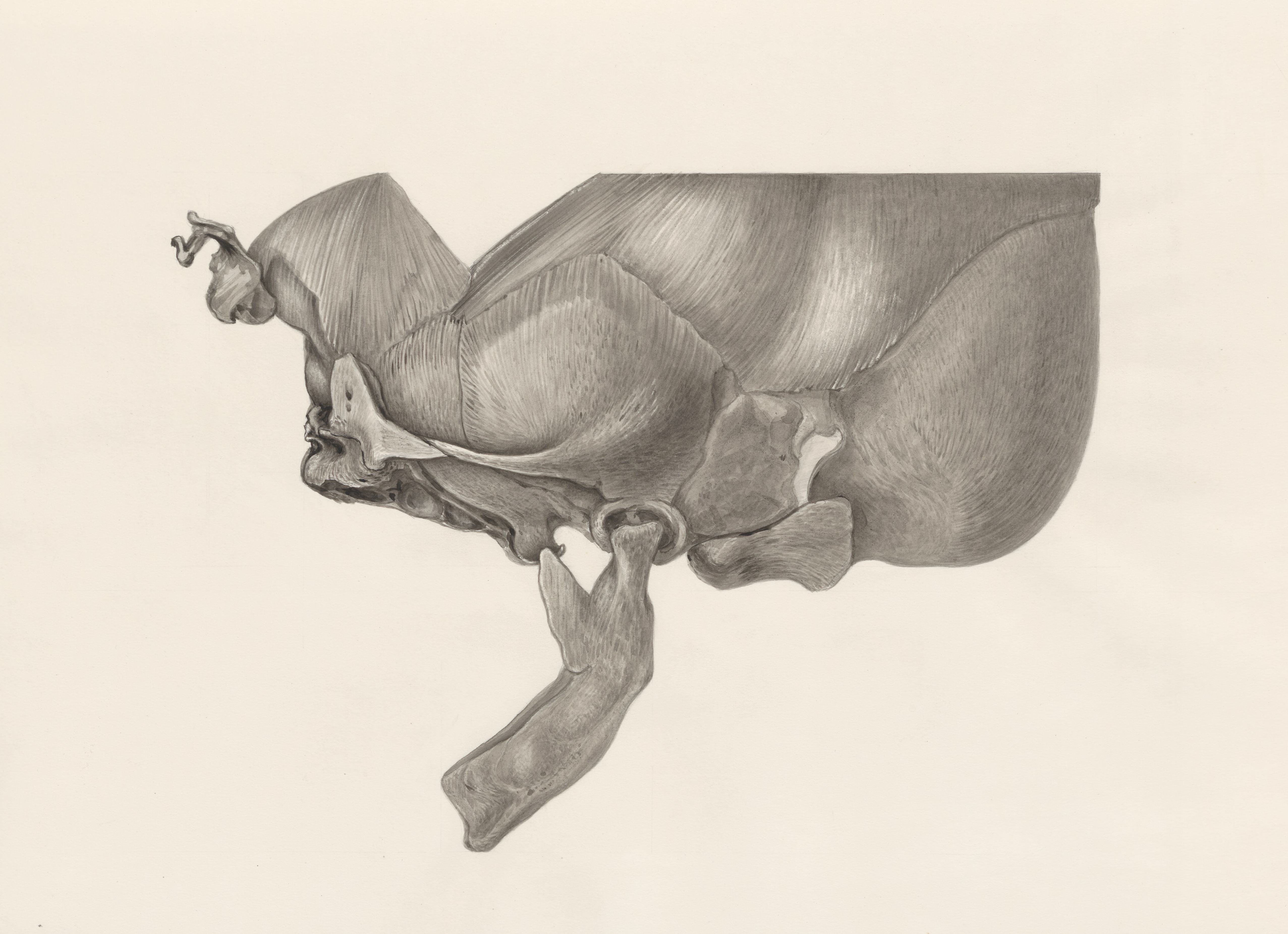 Deformed jawbone