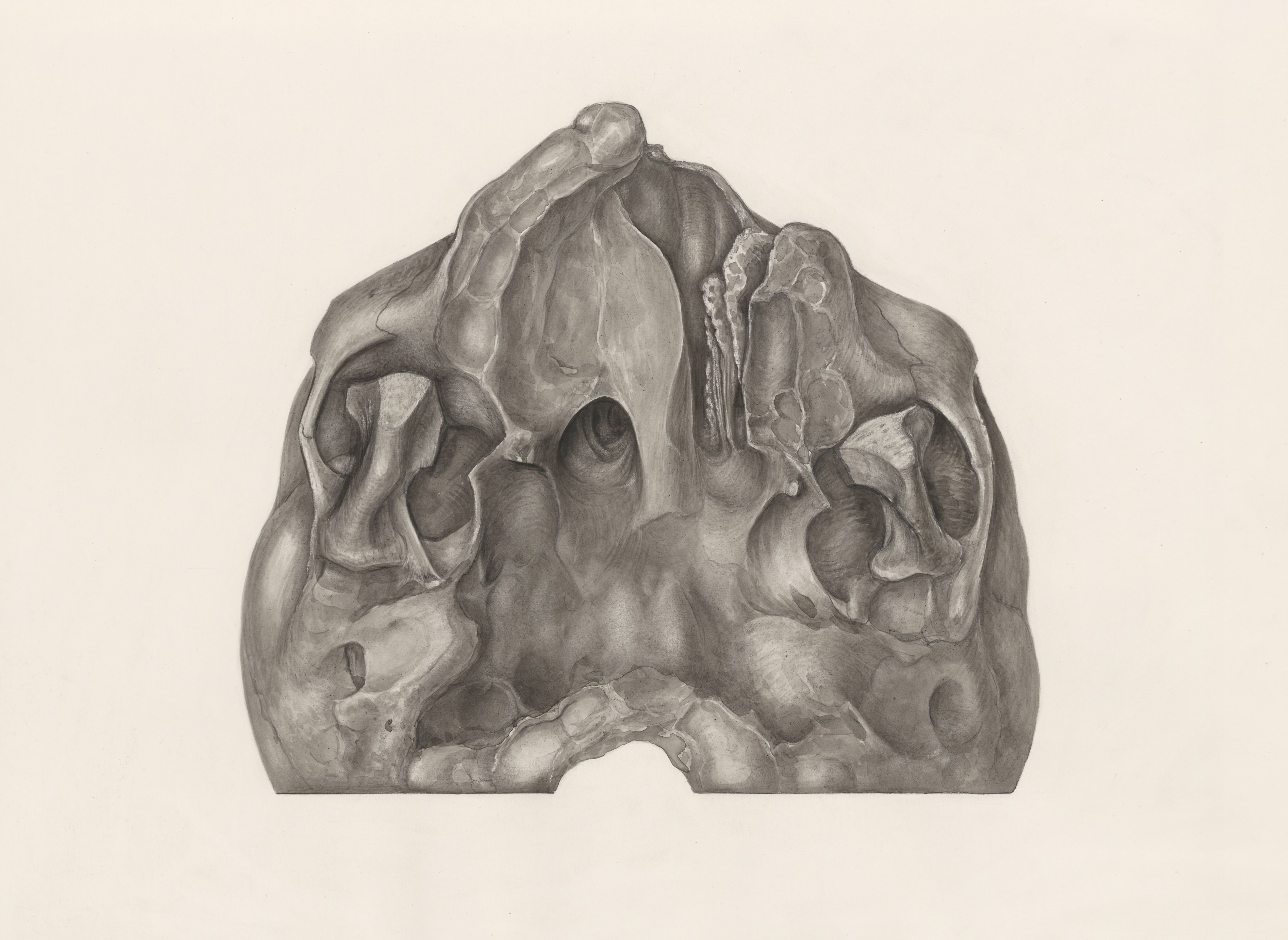 Deformed jawbone