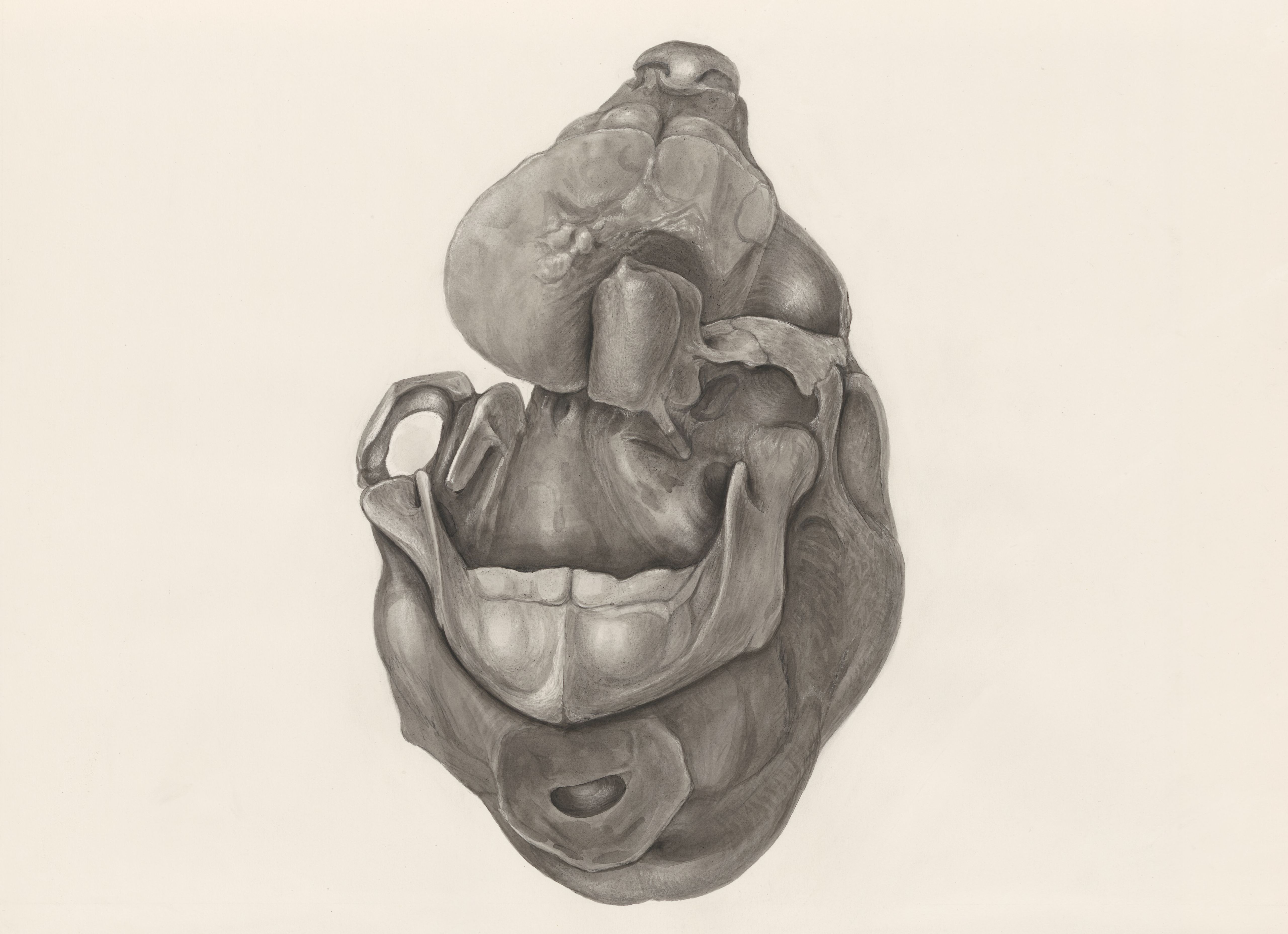 Deformed fetal head, seen from below